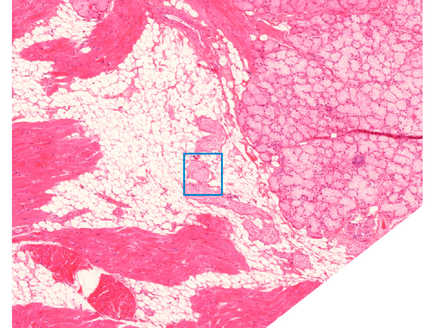 TP histologie — tissu nerveux page 7