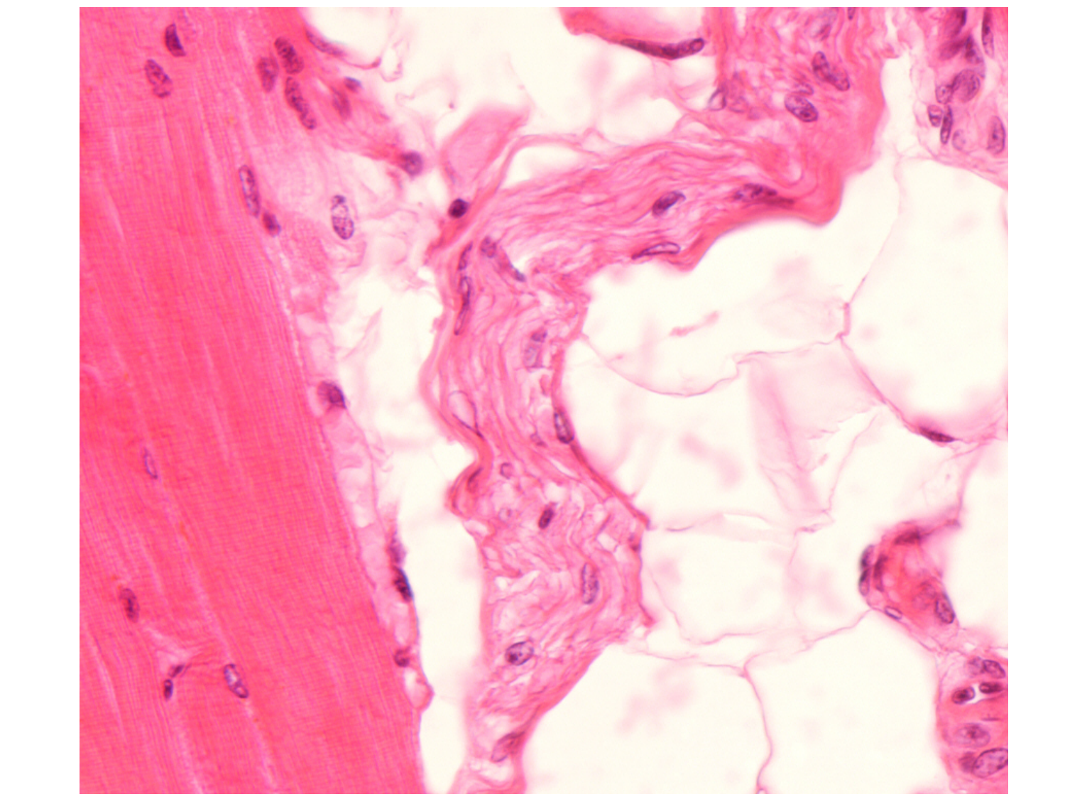 TP histologie — tissu nerveux page 10