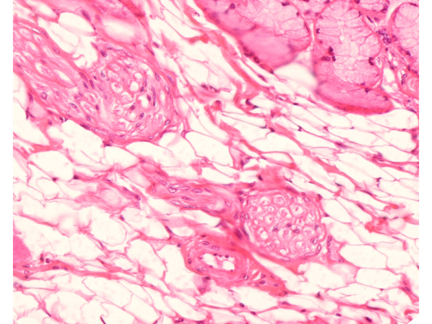 TP histologie — tissu nerveux page 11