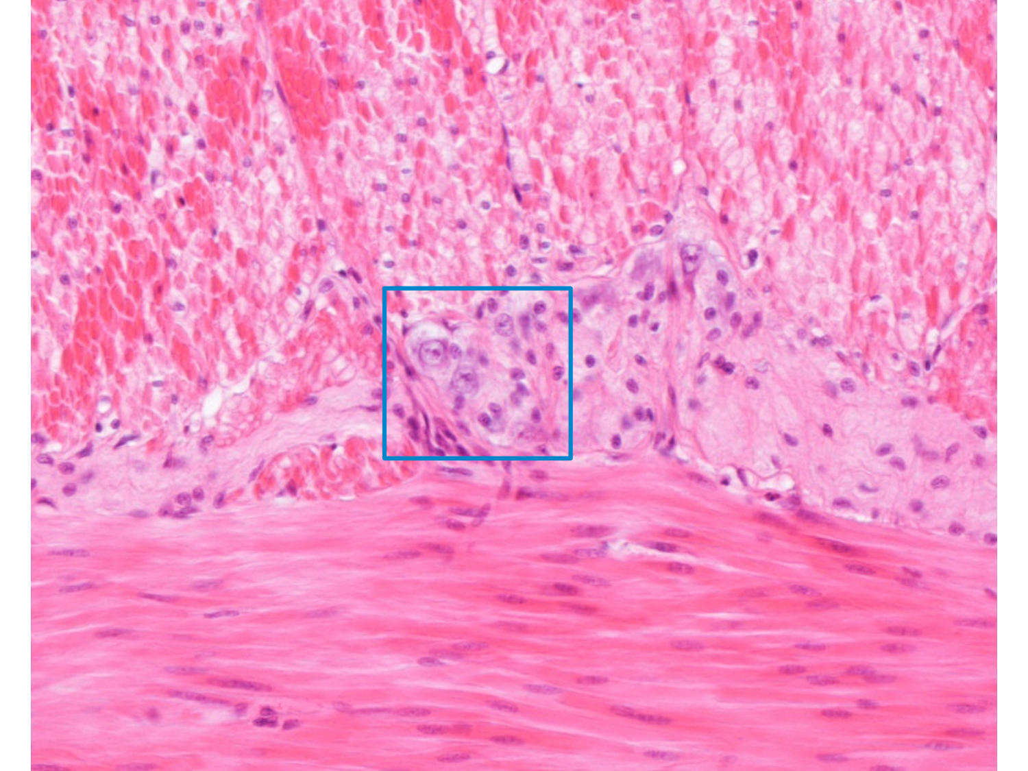 TP histologie — tissu nerveux page 23