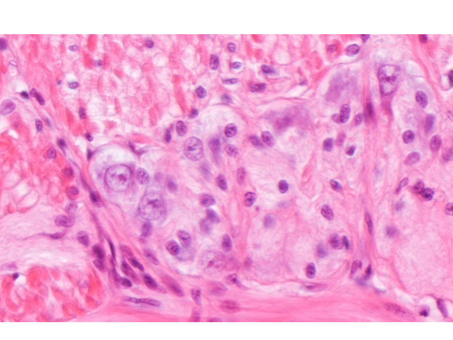 TP histologie — tissu nerveux page 24