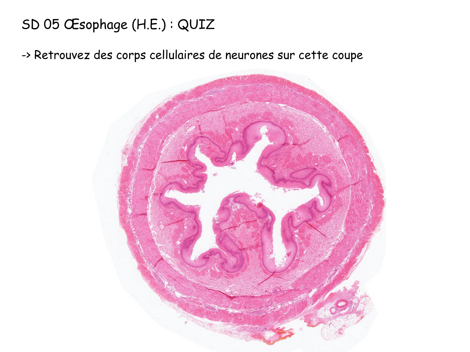 TP histologie — tissu nerveux page 25