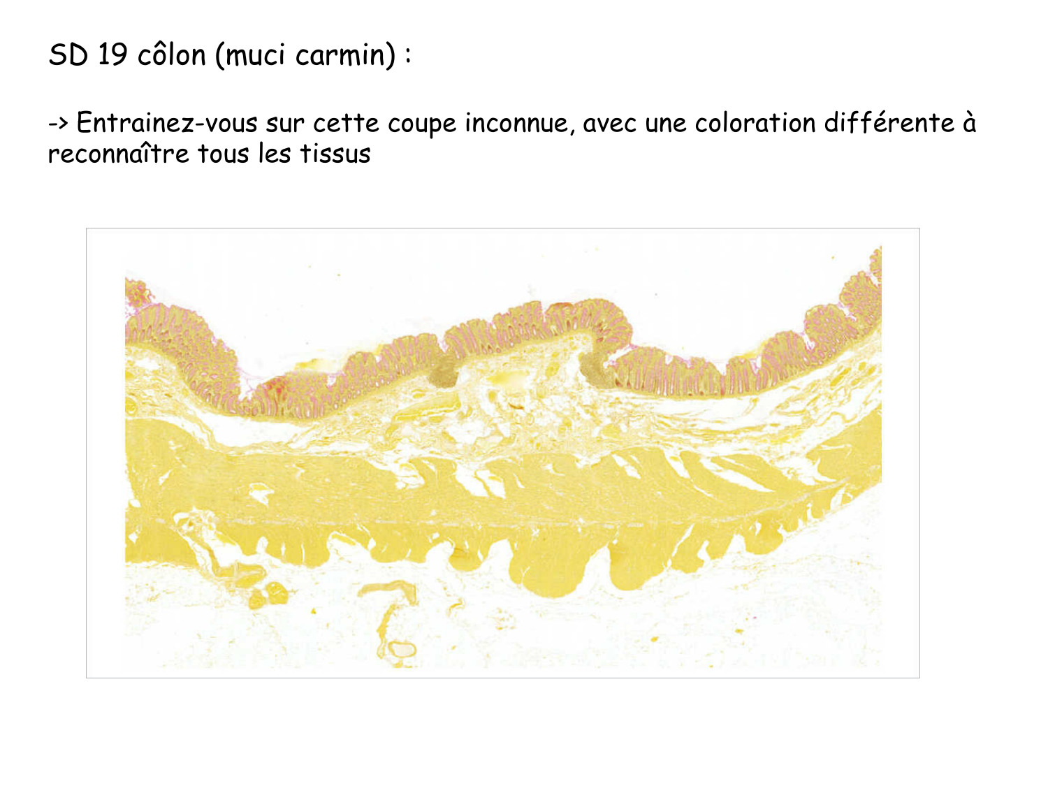 TP histologie — tissu nerveux page 26