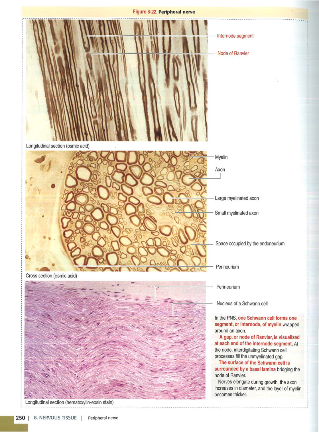 4 TN Kierszenbaum 3ed 230 238 240 249-250 page 5