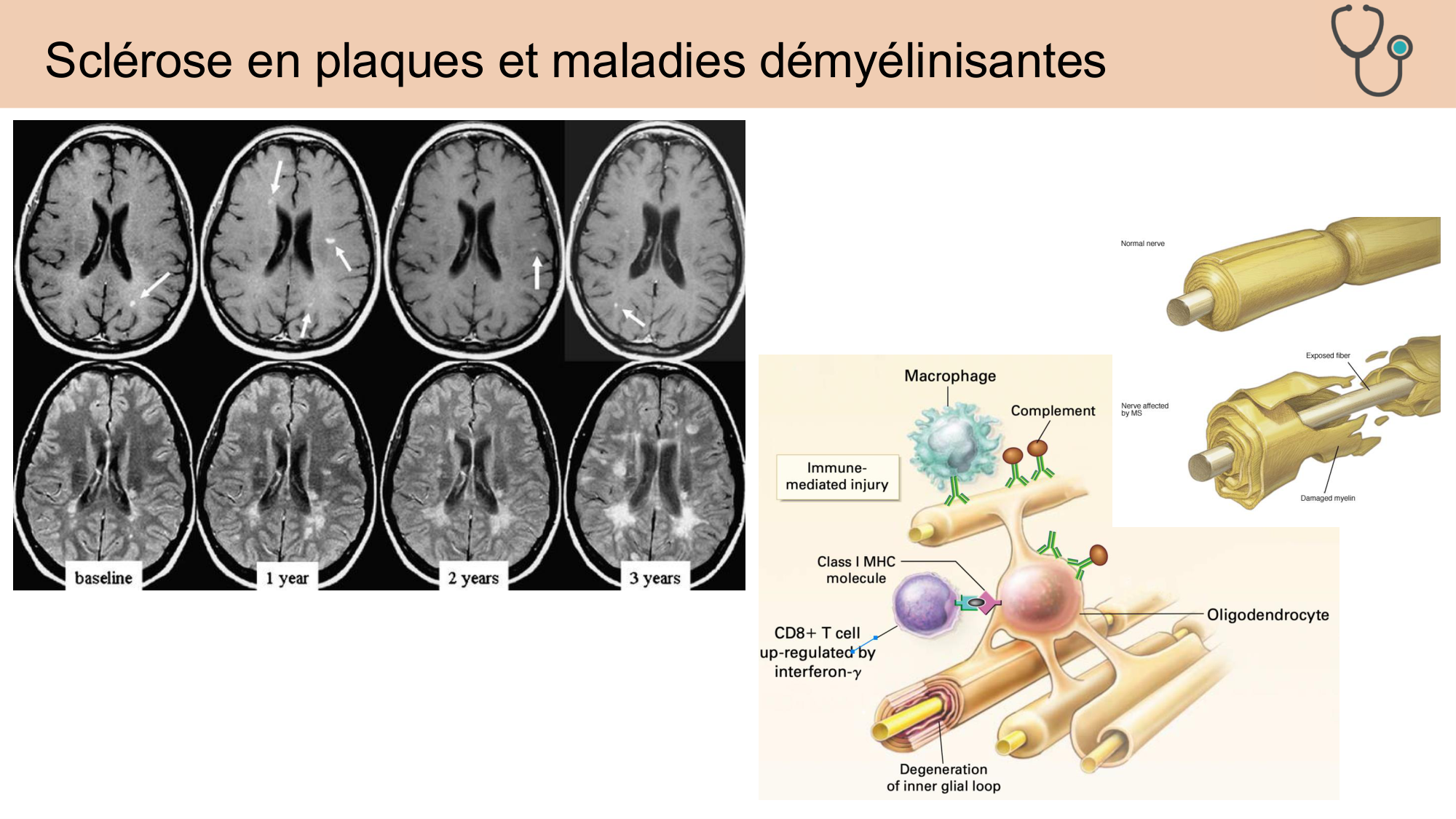 Tissu nerveux I page 54