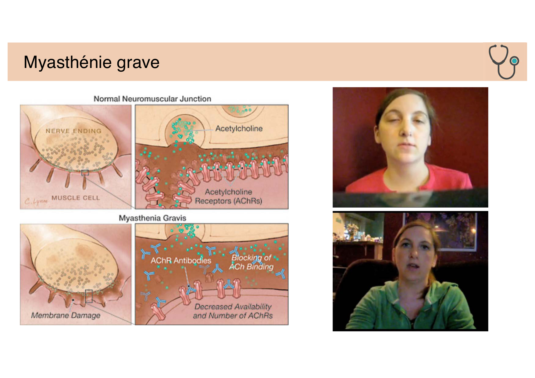 Tissu nerveux II page 16