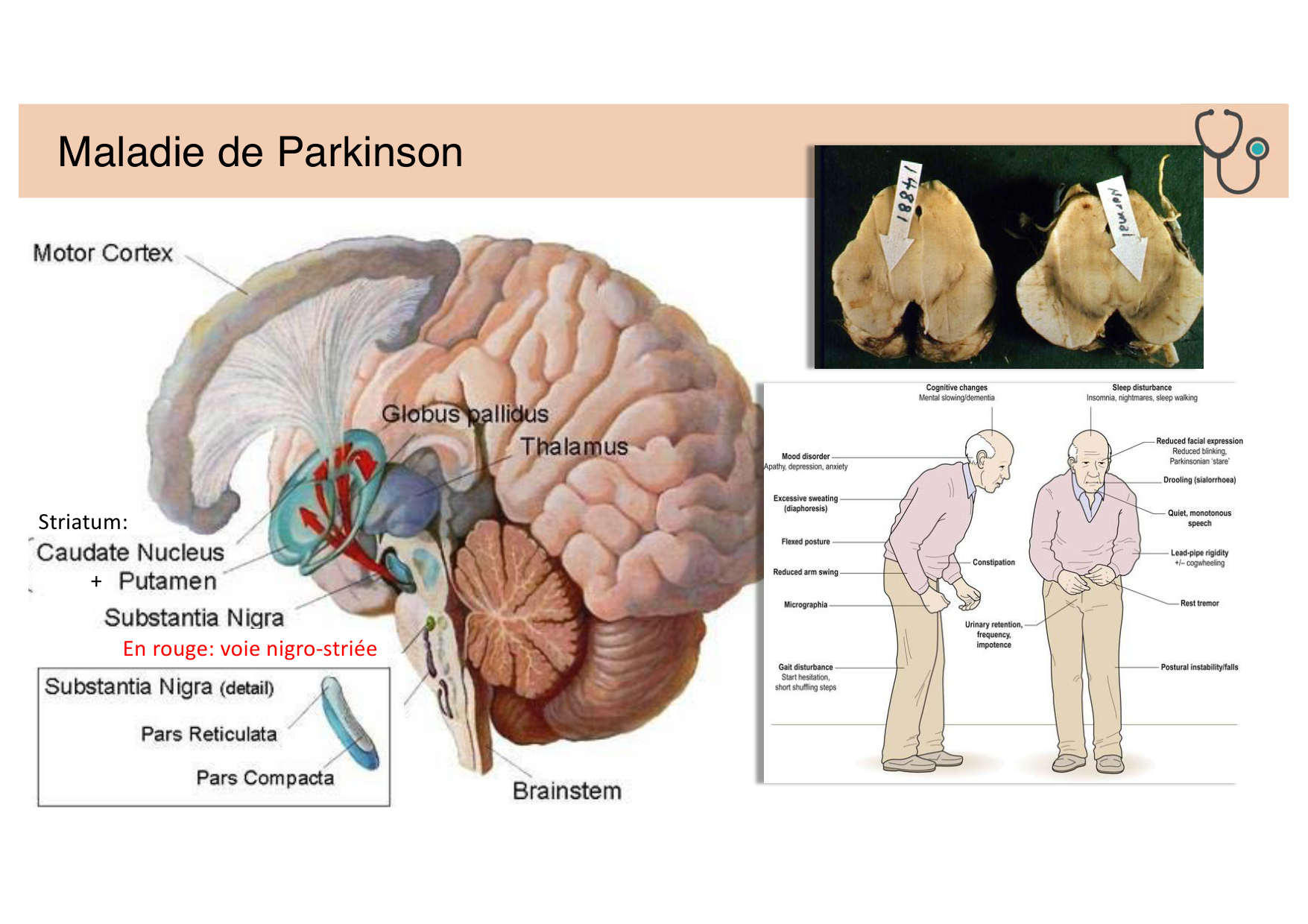 Tissu nerveux II page 20