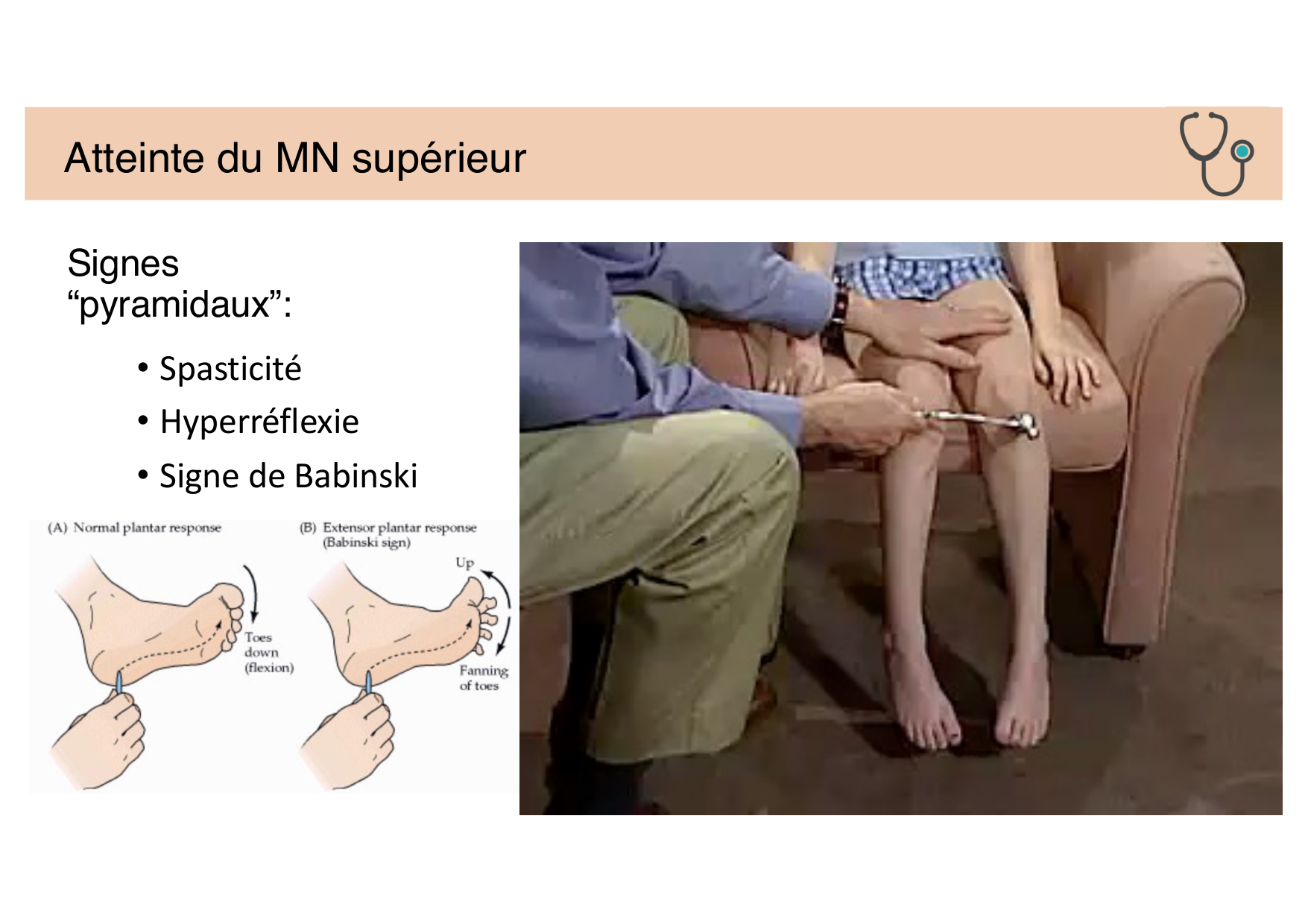 Tissu nerveux IV — moteur et sensitif page 24