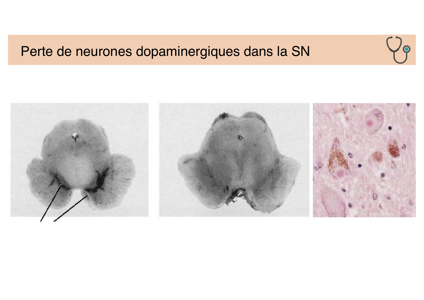 Tissu nerveux IV — moteur et sensitif page 34