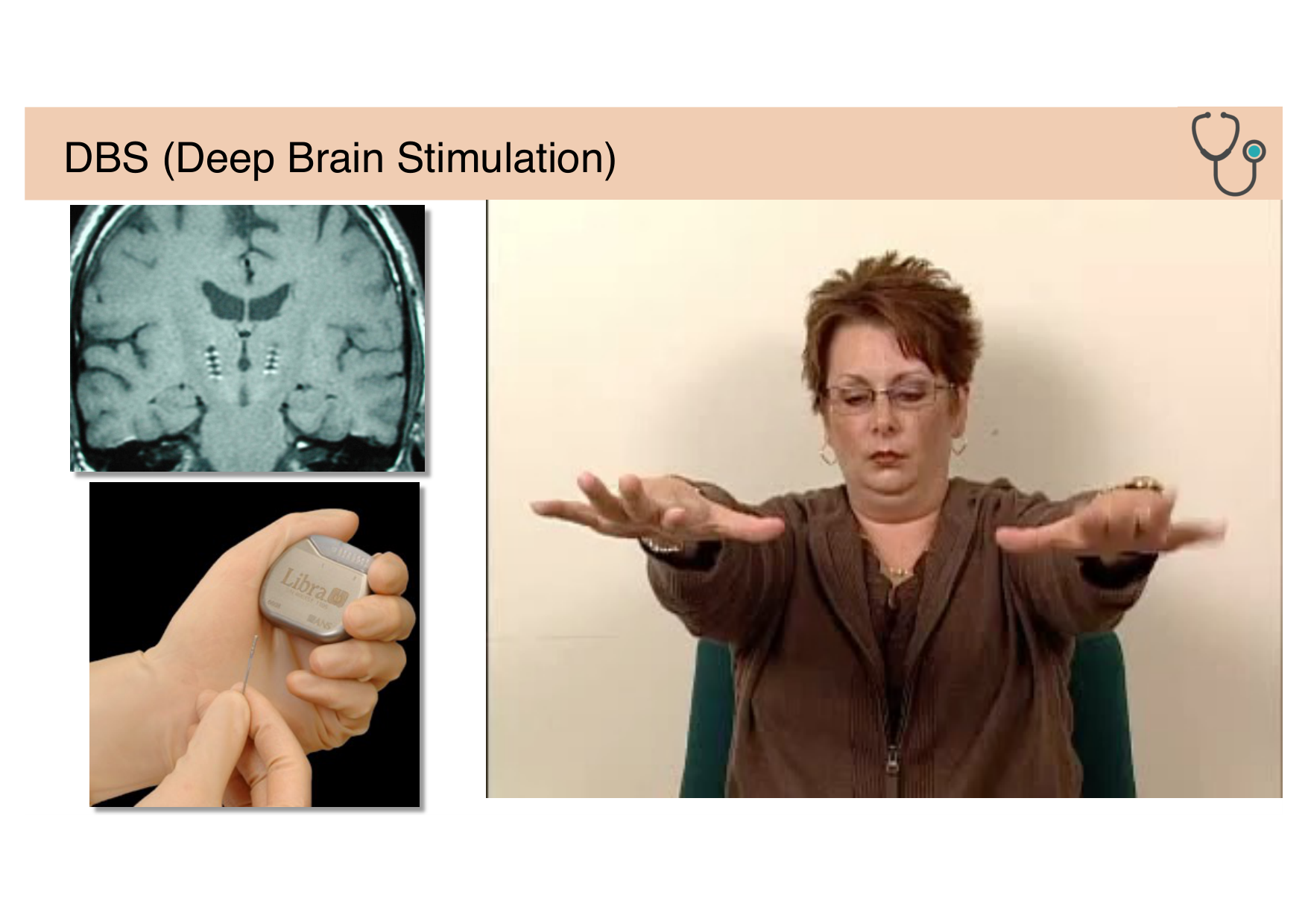 Tissu nerveux IV — moteur et sensitif page 38