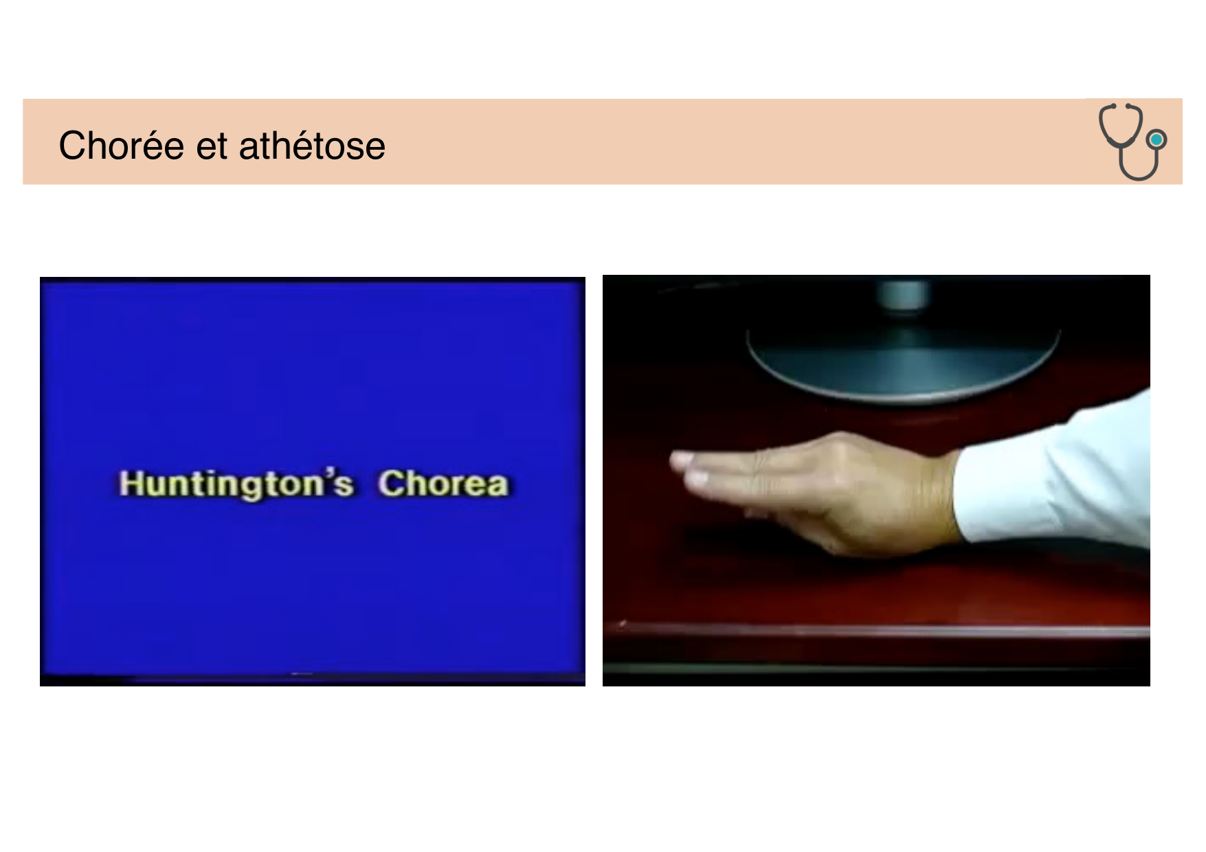 Tissu nerveux IV — moteur et sensitif page 41