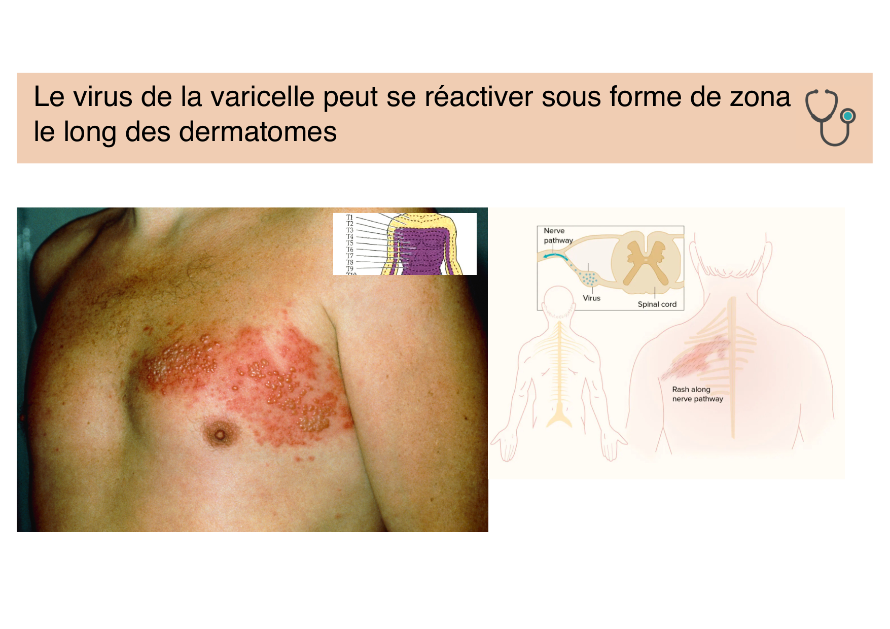 Tissu nerveux IV — moteur et sensitif page 48