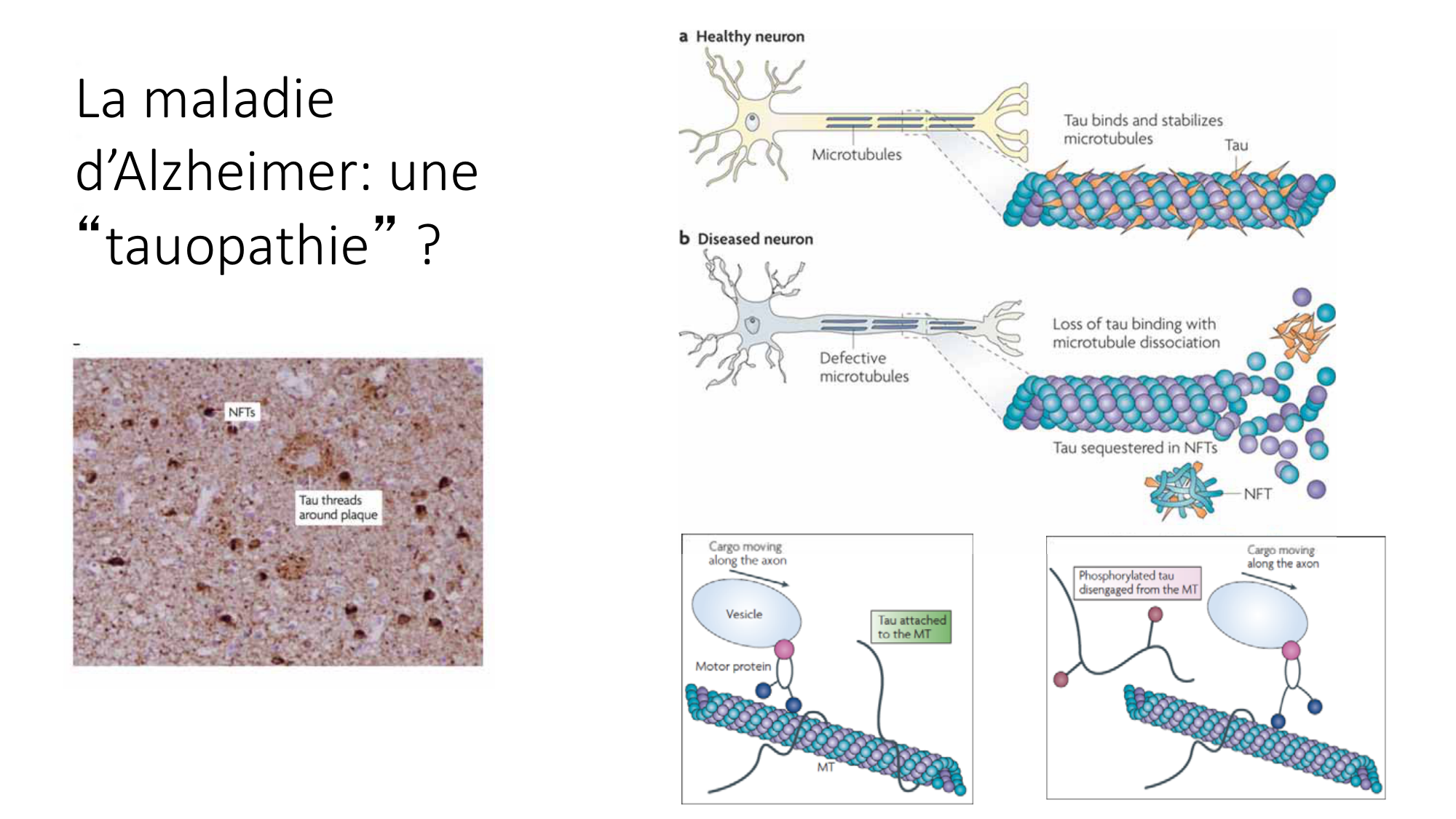 Jabaudon Cours1 14Nov2016 page 17