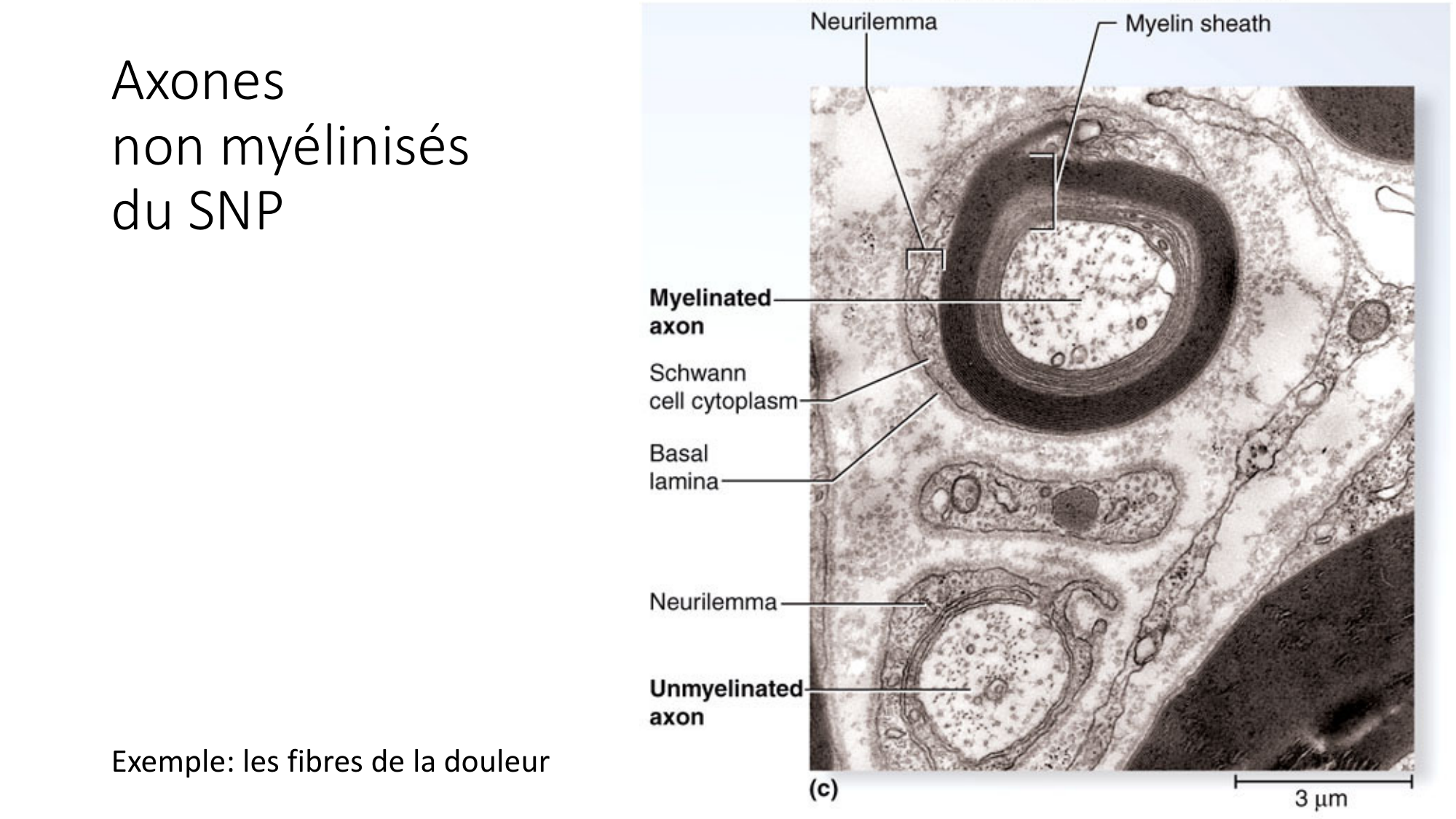 Jabaudon Cours1 14Nov2016 page 44