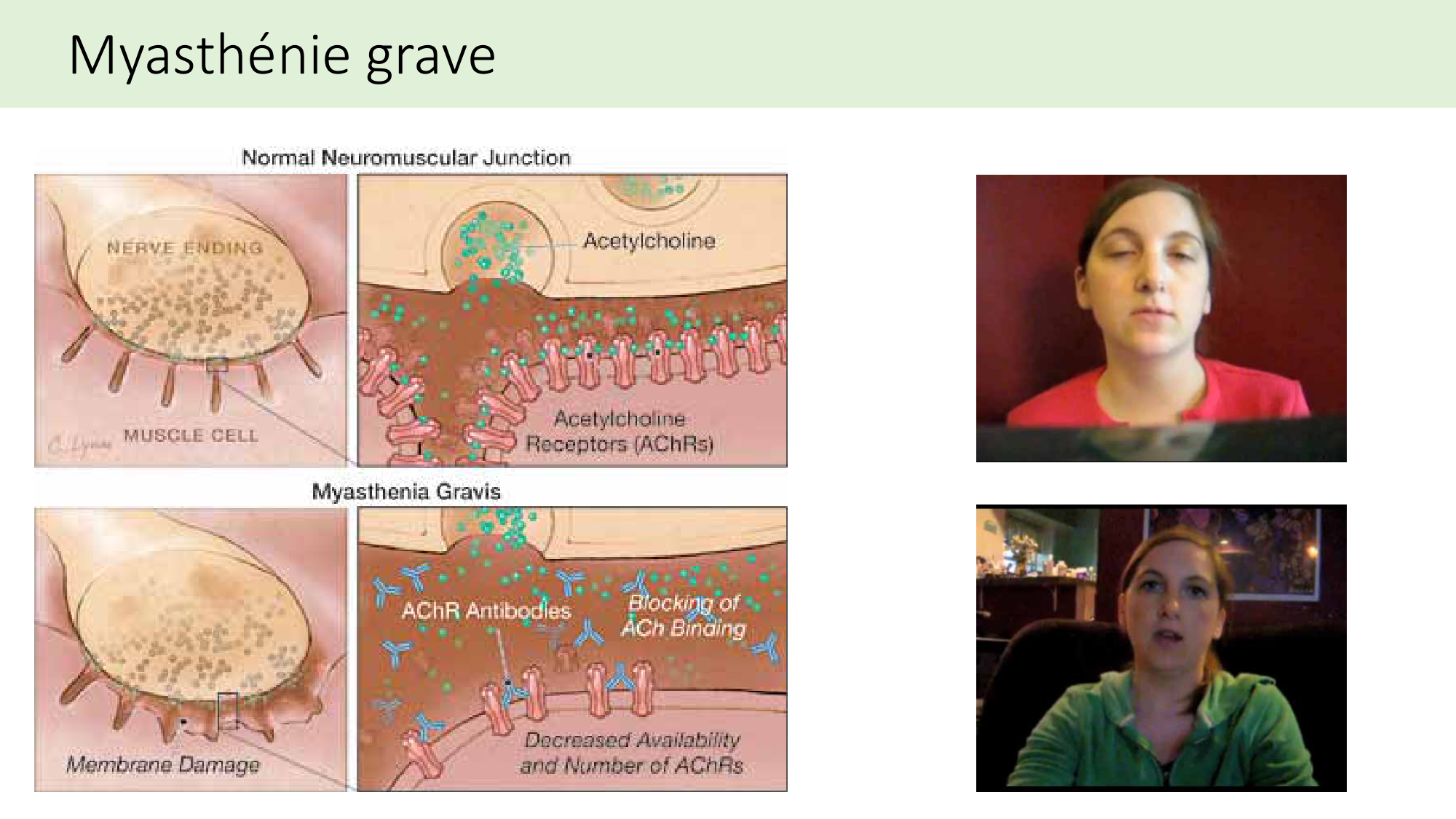 Jabaudon Cours2 17Nov2016 page 23