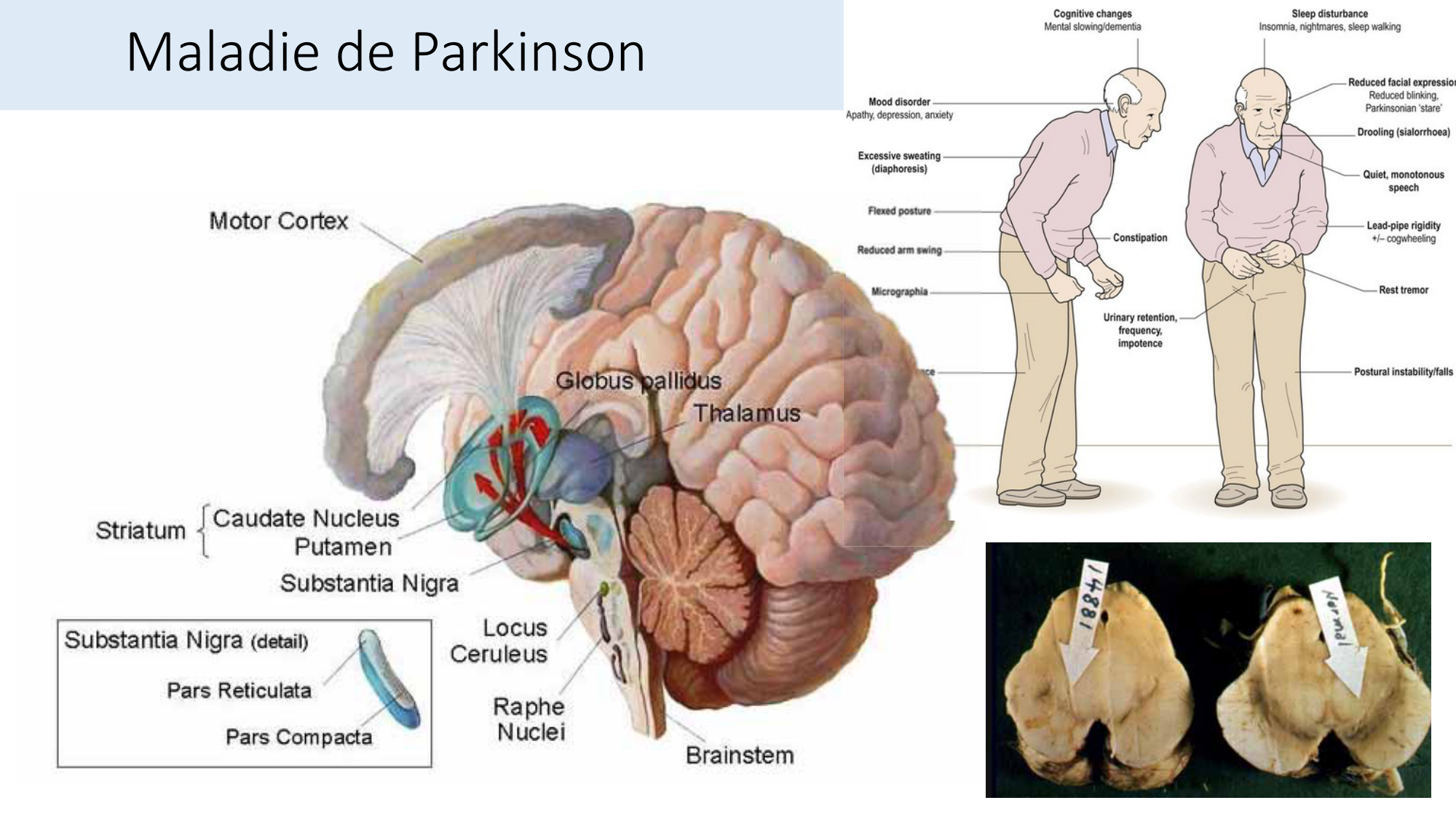 Jabaudon Cours2 17Nov2016 page 28