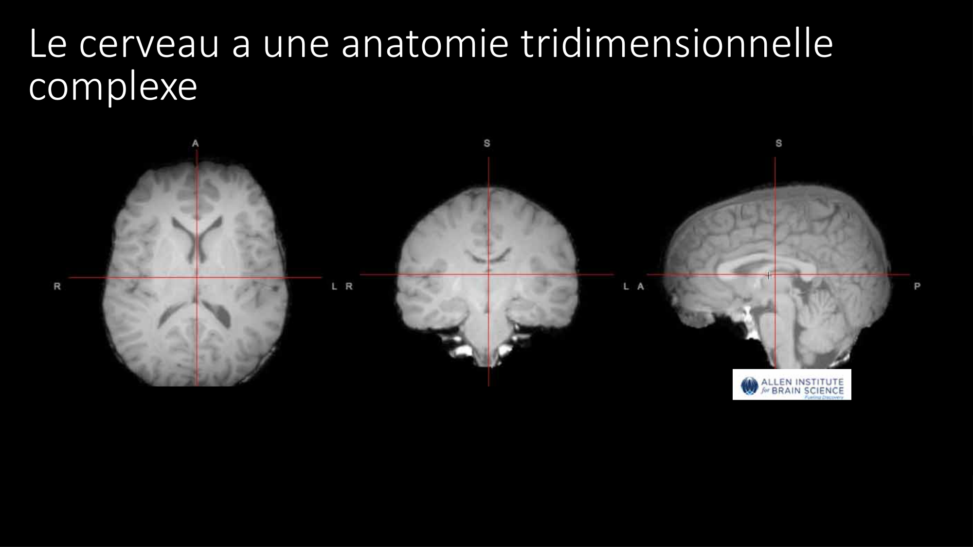 Jabaudon Cours2 17Nov2016 page 46