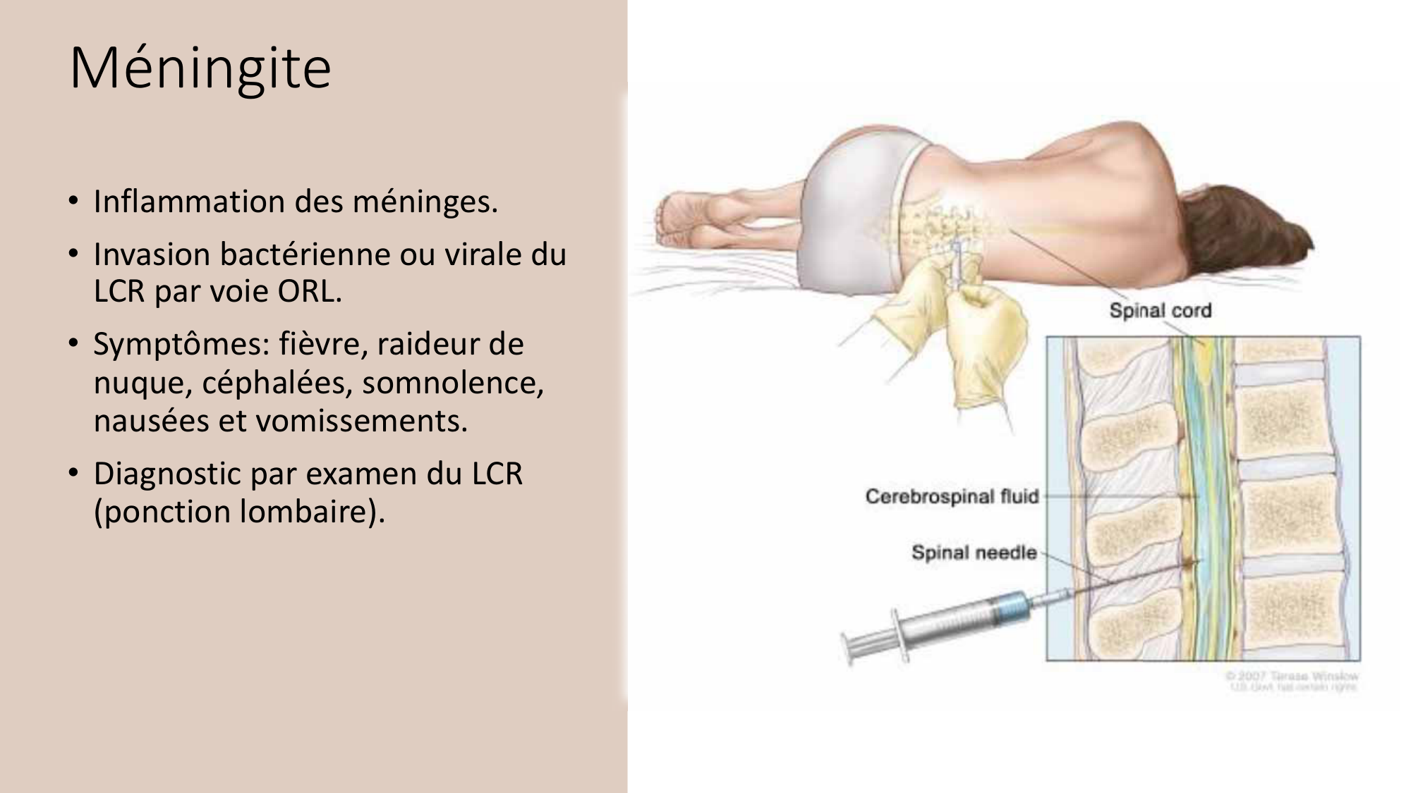 Jabaudon Cours2 17Nov2016 page 59
