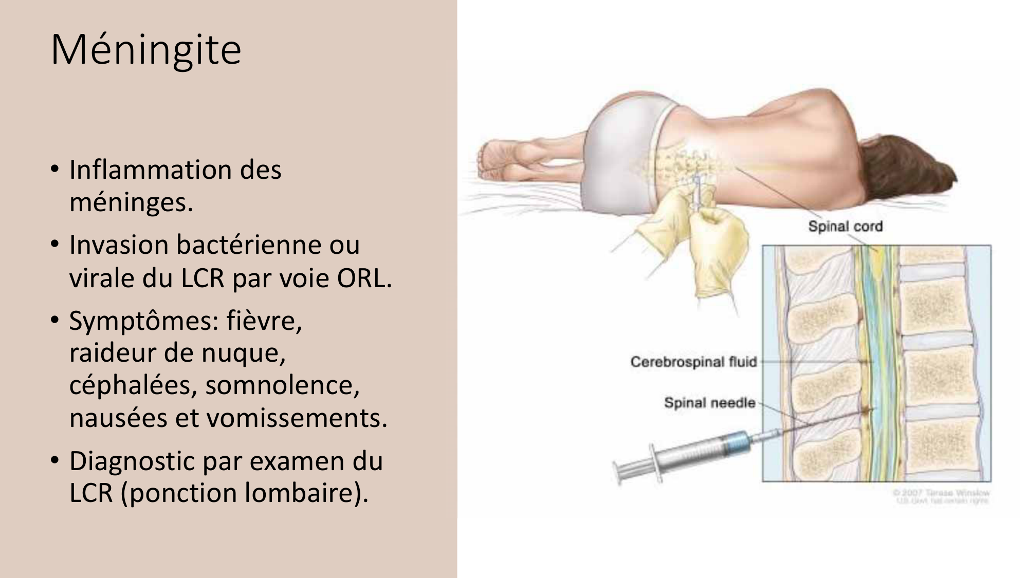 Jabaudon Cours3 23Nov2016 page 22