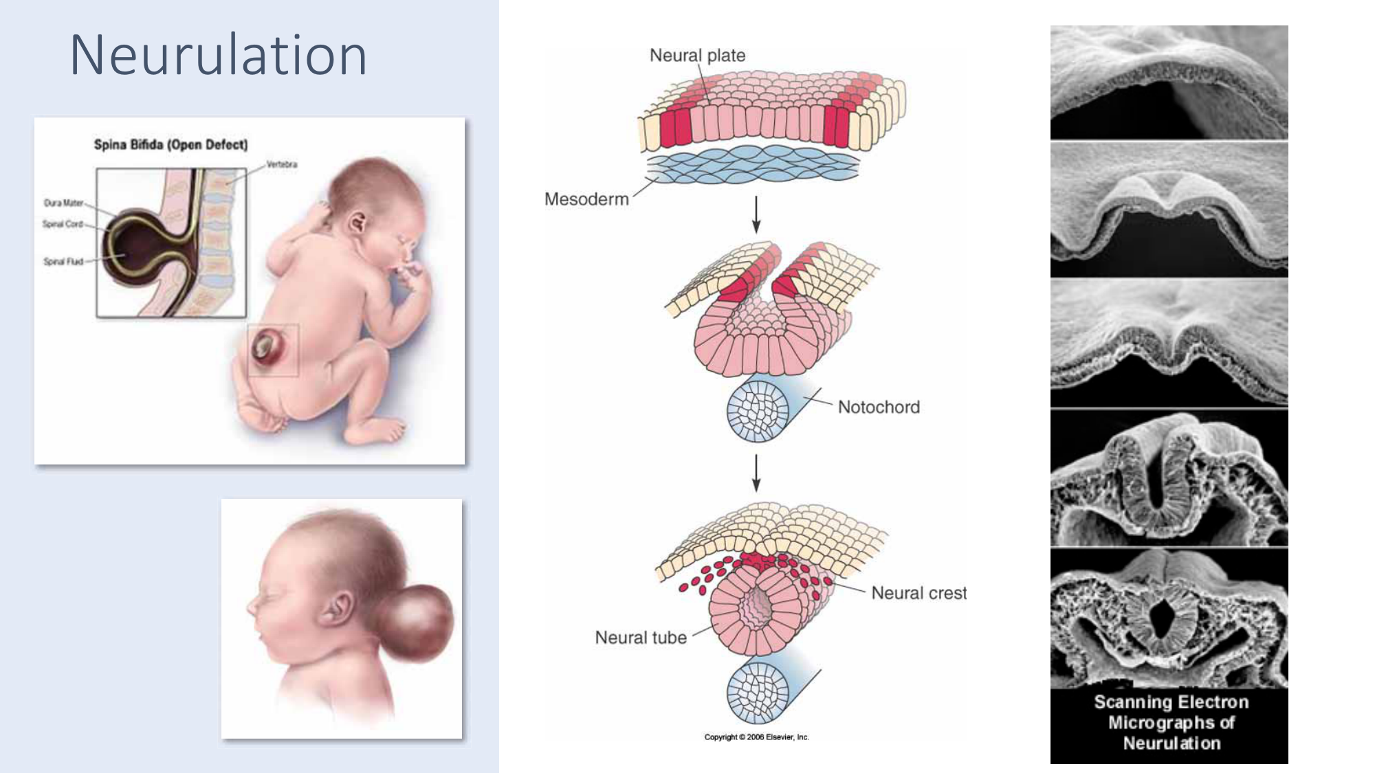Jabaudon Cours3 23Nov2016 page 25