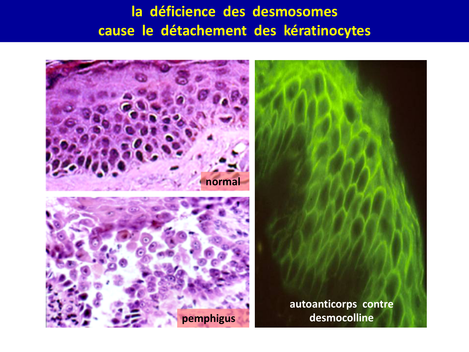 Molécules d’adhésion cellulaire page 29