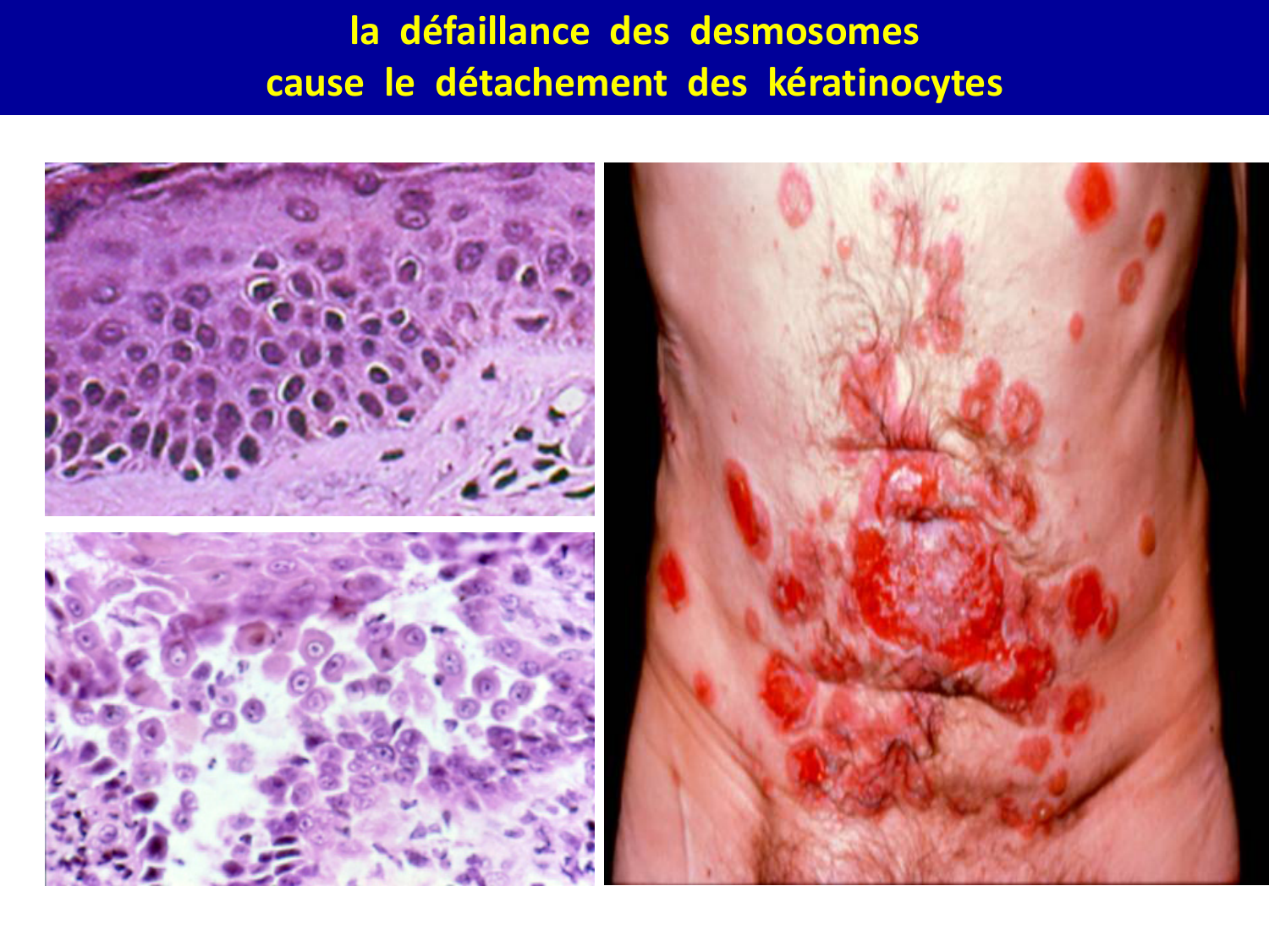Molécules d’adhésion cellulaire page 30