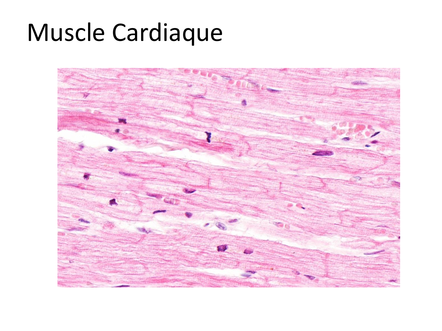 Tissu musculaire page 151