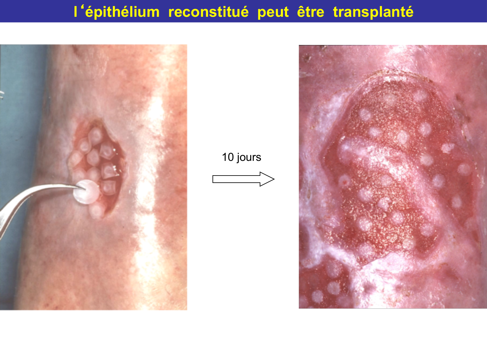 Tissu épithélial page 48