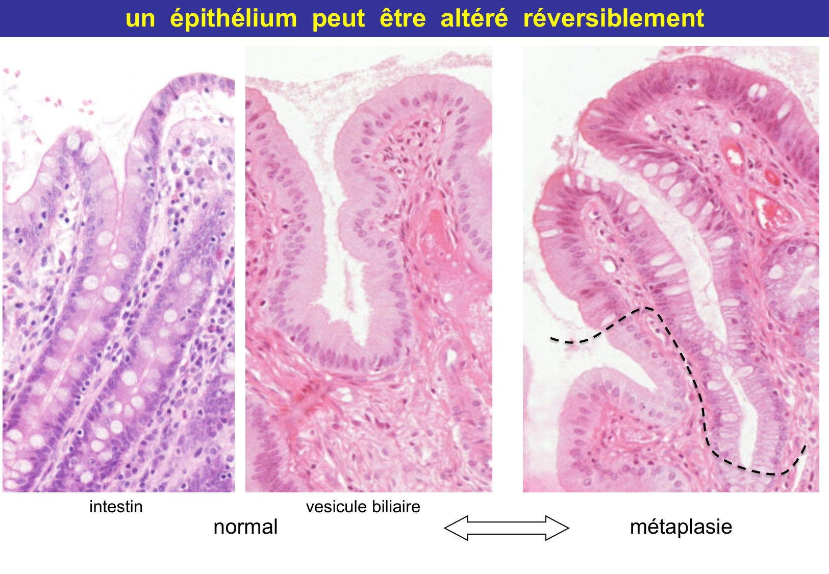 Tissu épithélial page 63