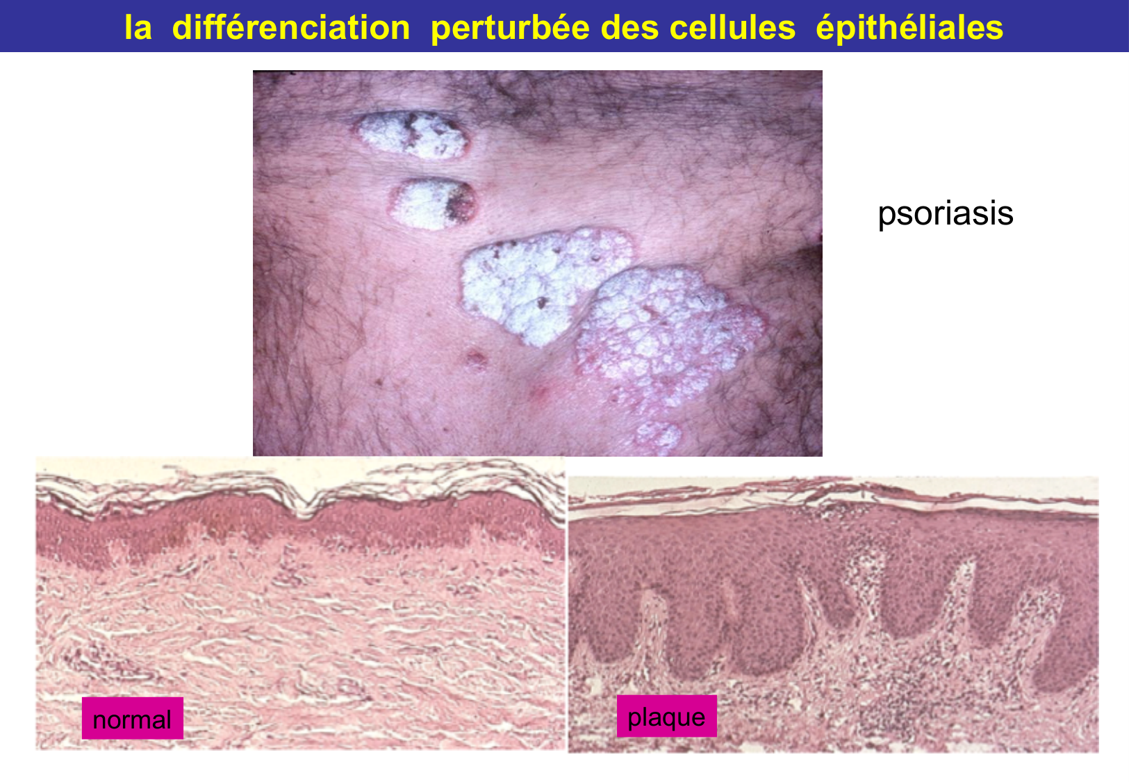 Tissu épithélial page 64