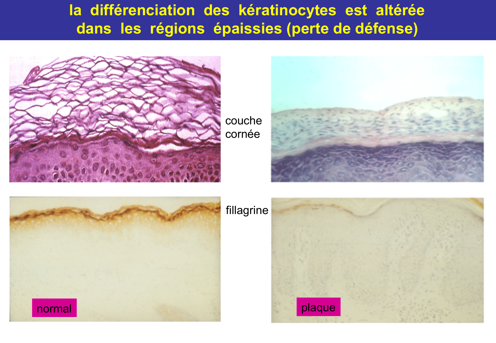 Tissu épithélial page 65