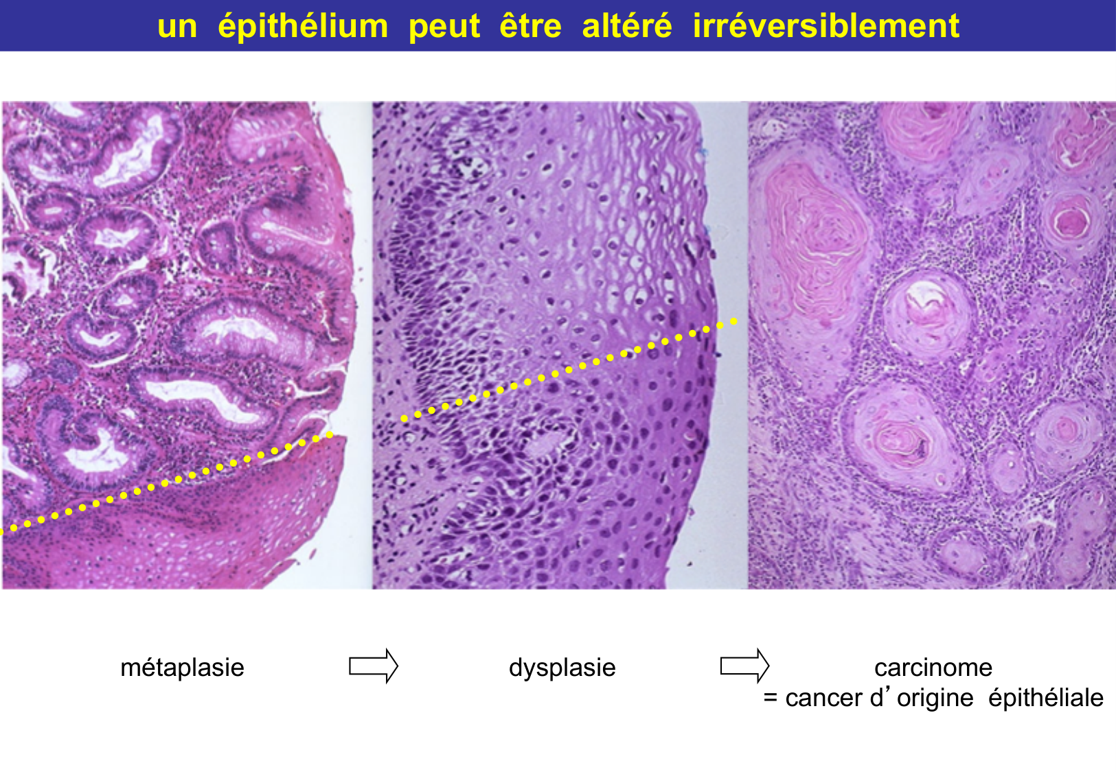 Tissu épithélial page 70