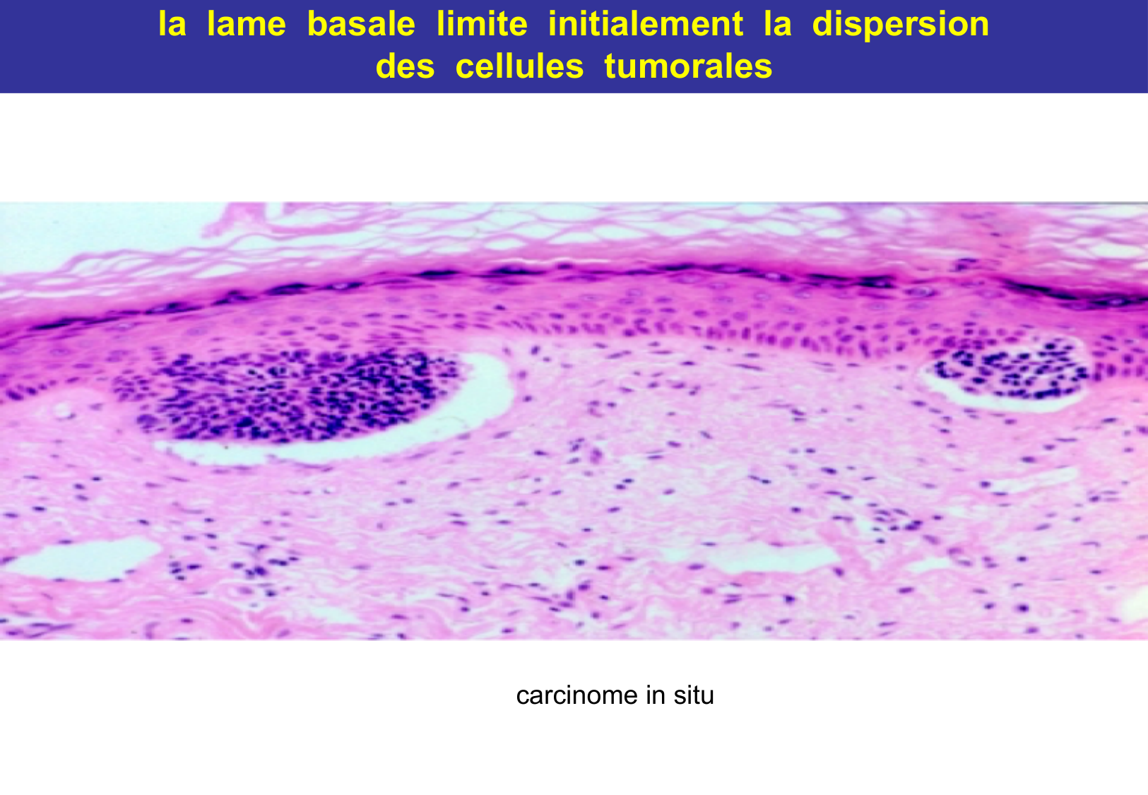 Tissu épithélial page 73