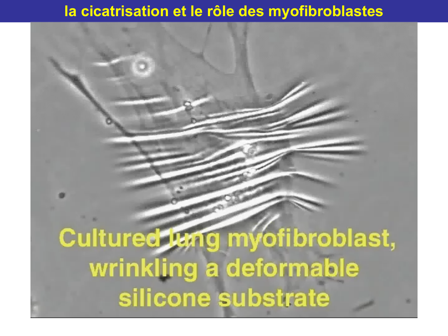 Tissu conjonctif page 61