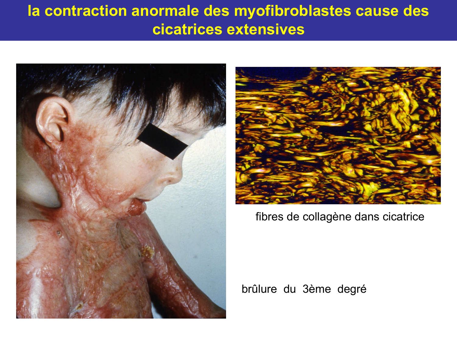 Tissu conjonctif page 66