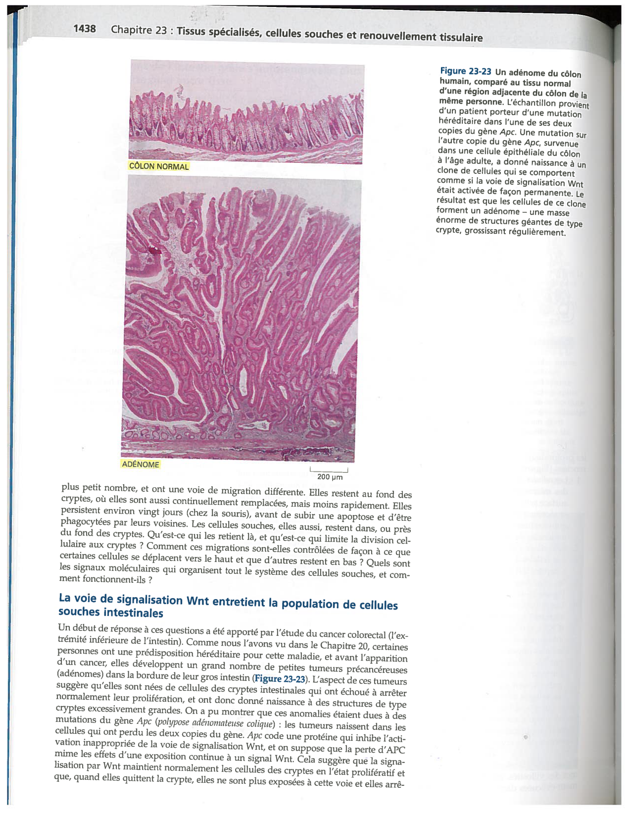 Alberts ed-5fr p1438-TE tumeur colorectale page 1