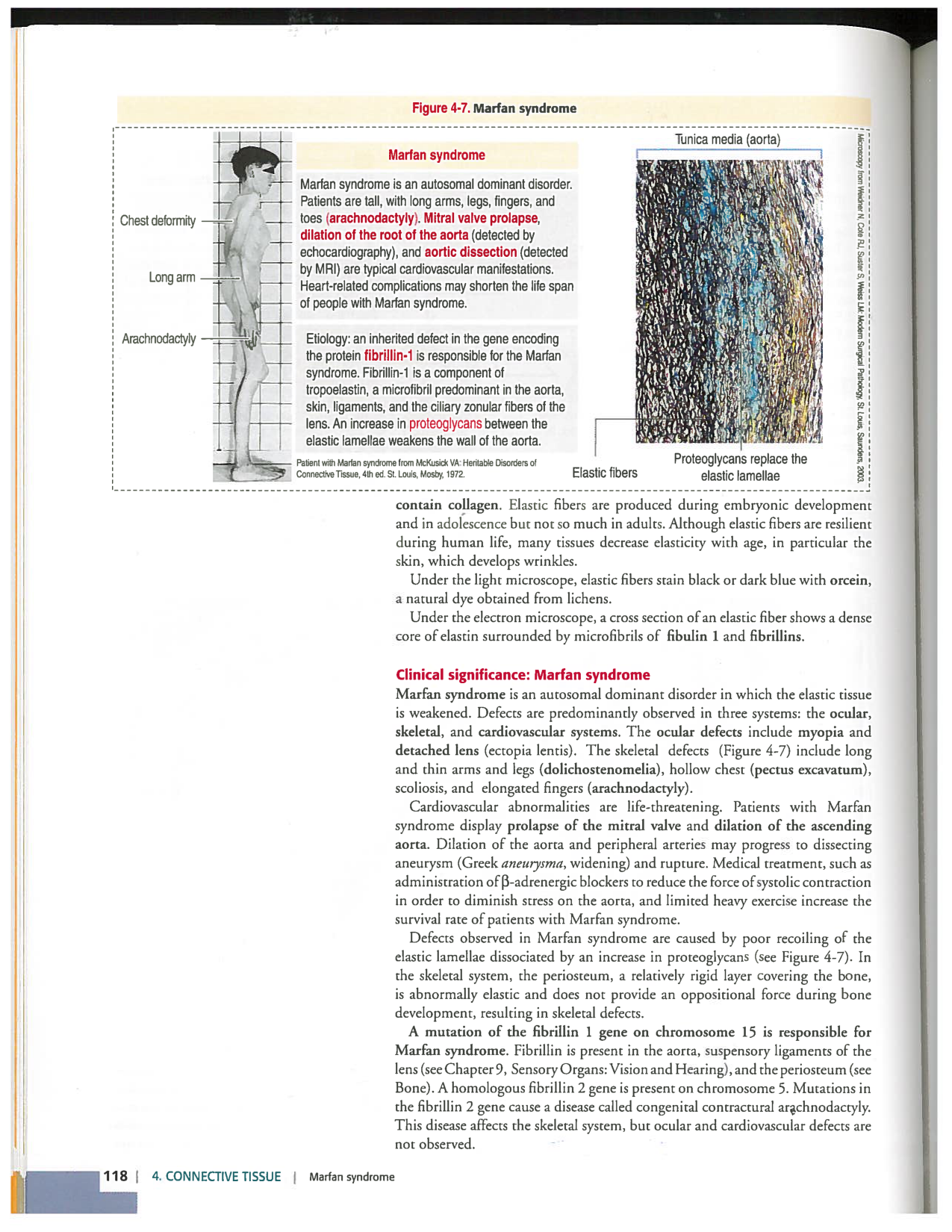 Kierszenbaum ed-4 p111-146-TC-examples et pathologies page 8