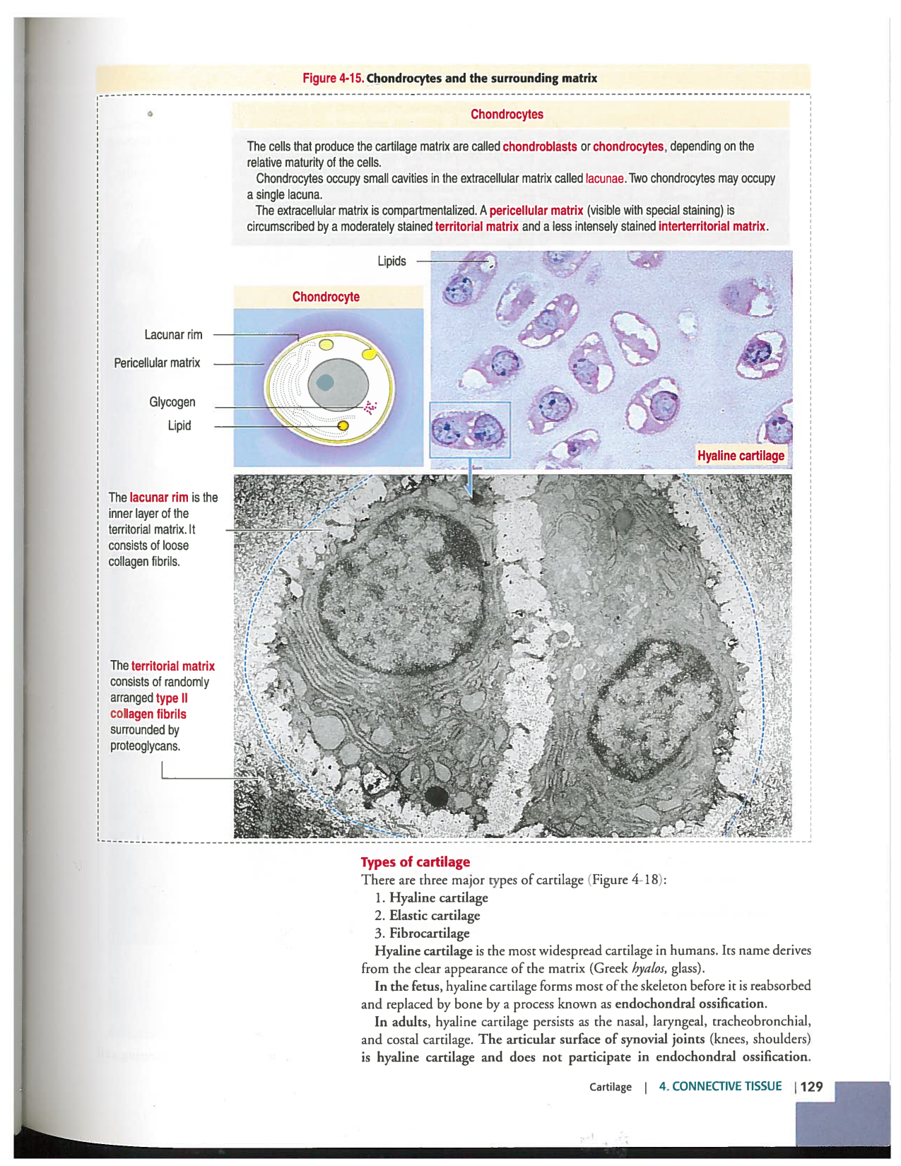 Kierszenbaum ed-4 p111-146-TC-examples et pathologies page 19