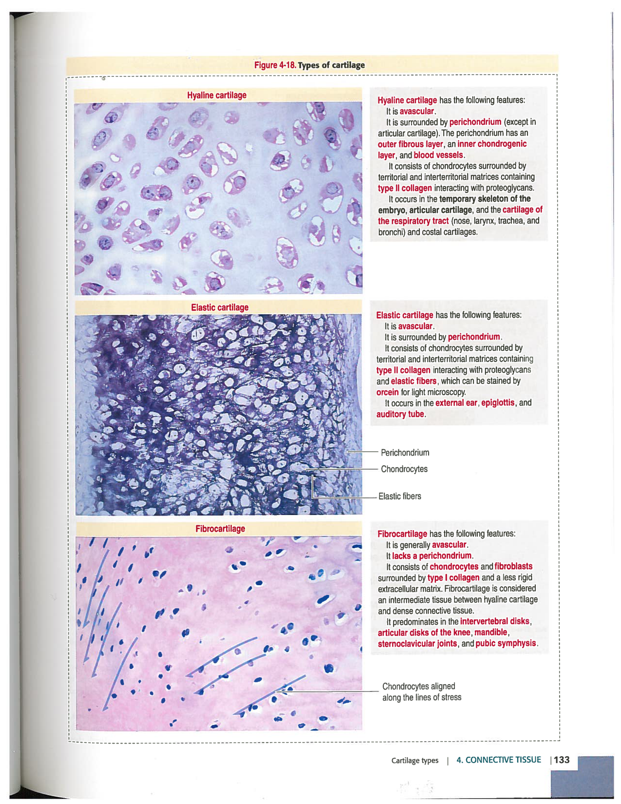 Kierszenbaum ed-4 p111-146-TC-examples et pathologies page 23