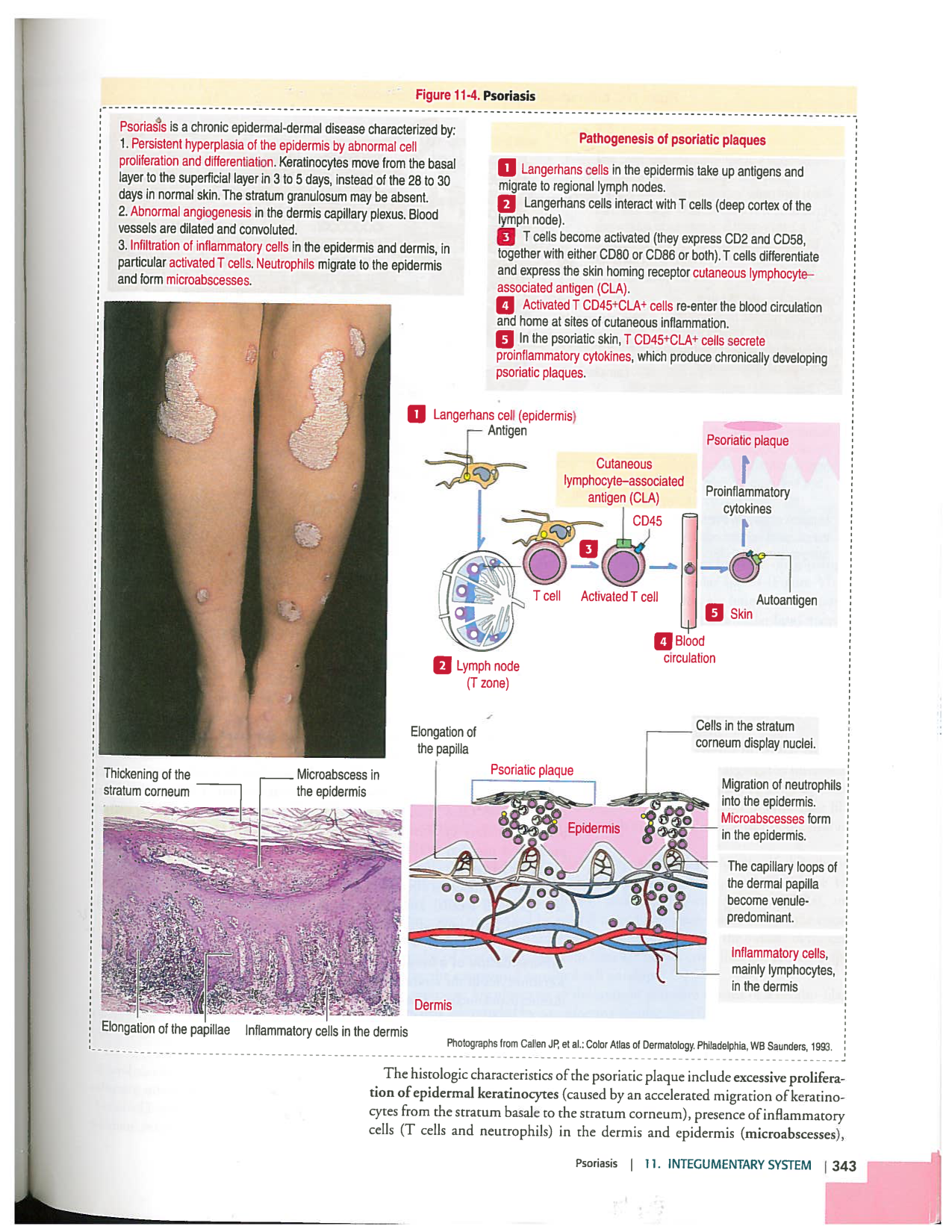 Kierszenbaum ed-4 p339-356-TE la-peau normal et psoriasis page 5