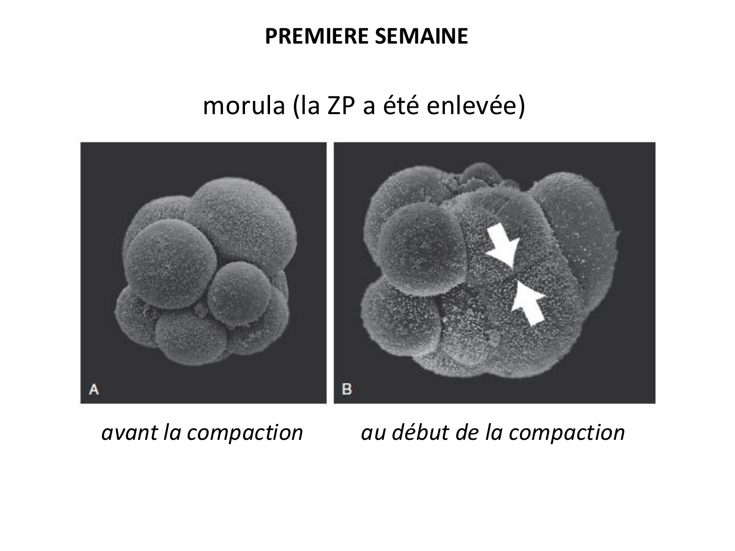Développement — semaines 1 et 2 page 13