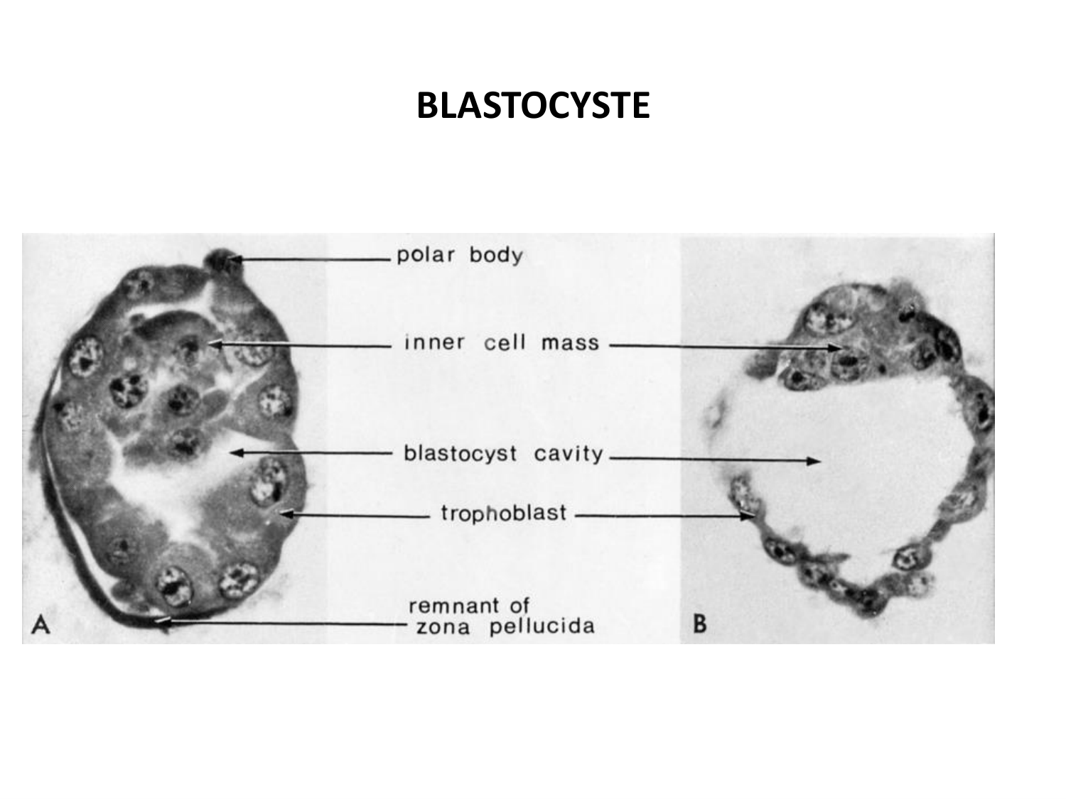 Développement — semaines 1 et 2 page 17