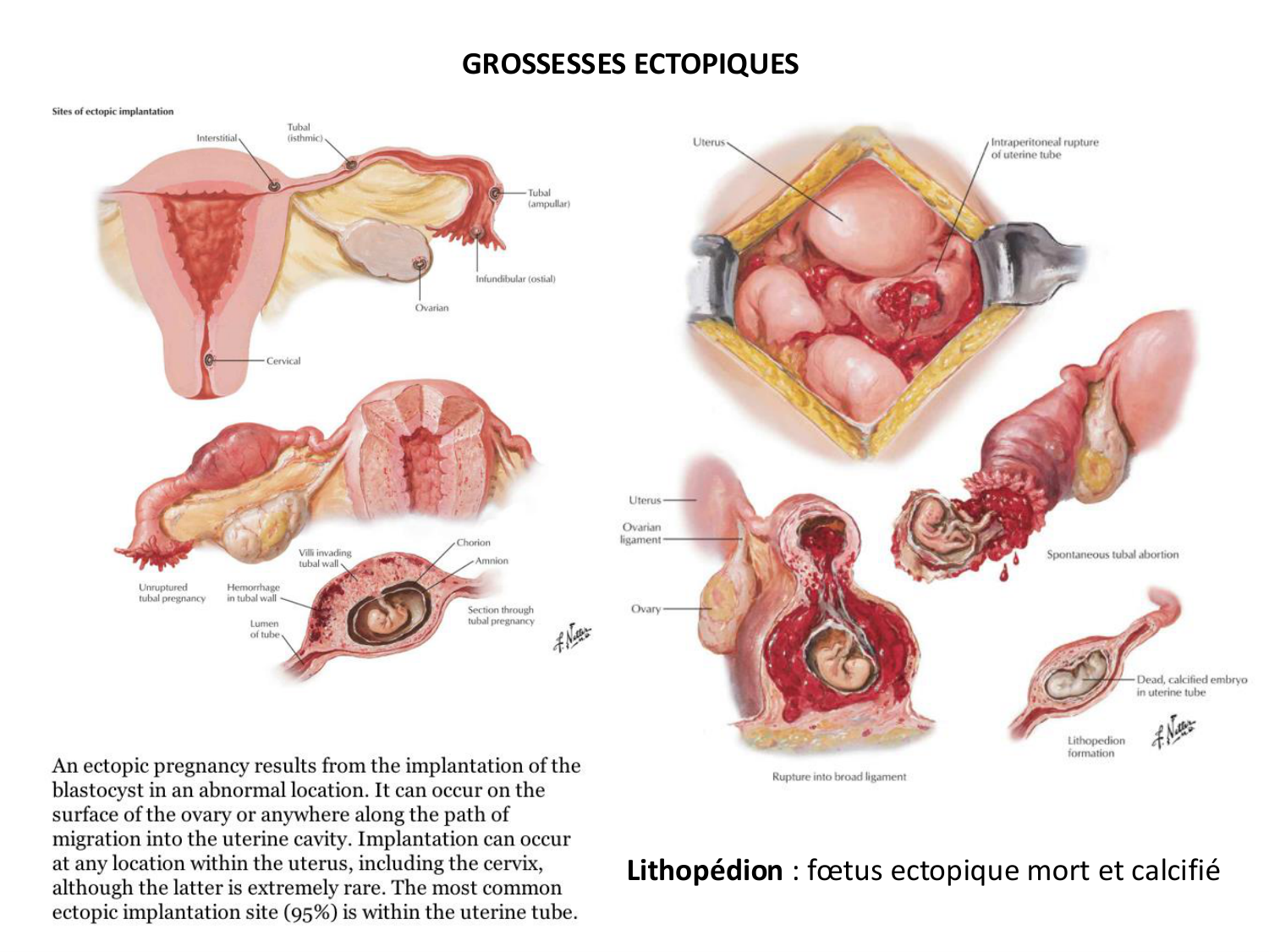Développement — semaines 1 et 2 page 43