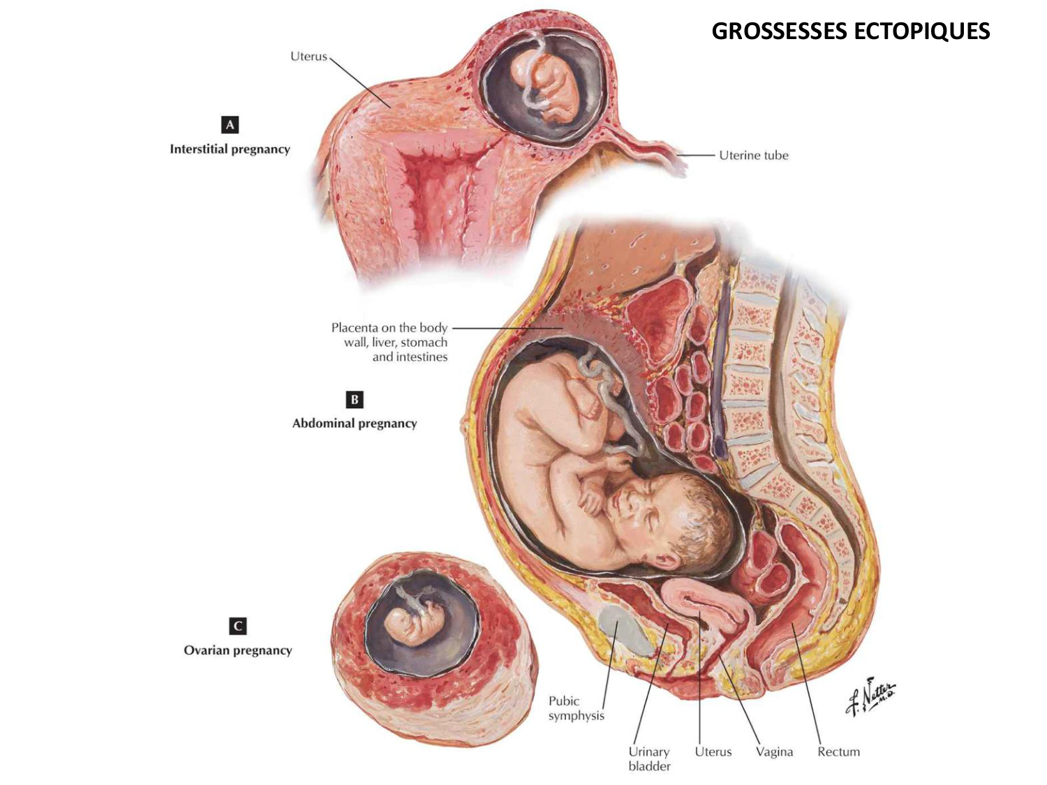 Développement — semaines 1 et 2 page 44