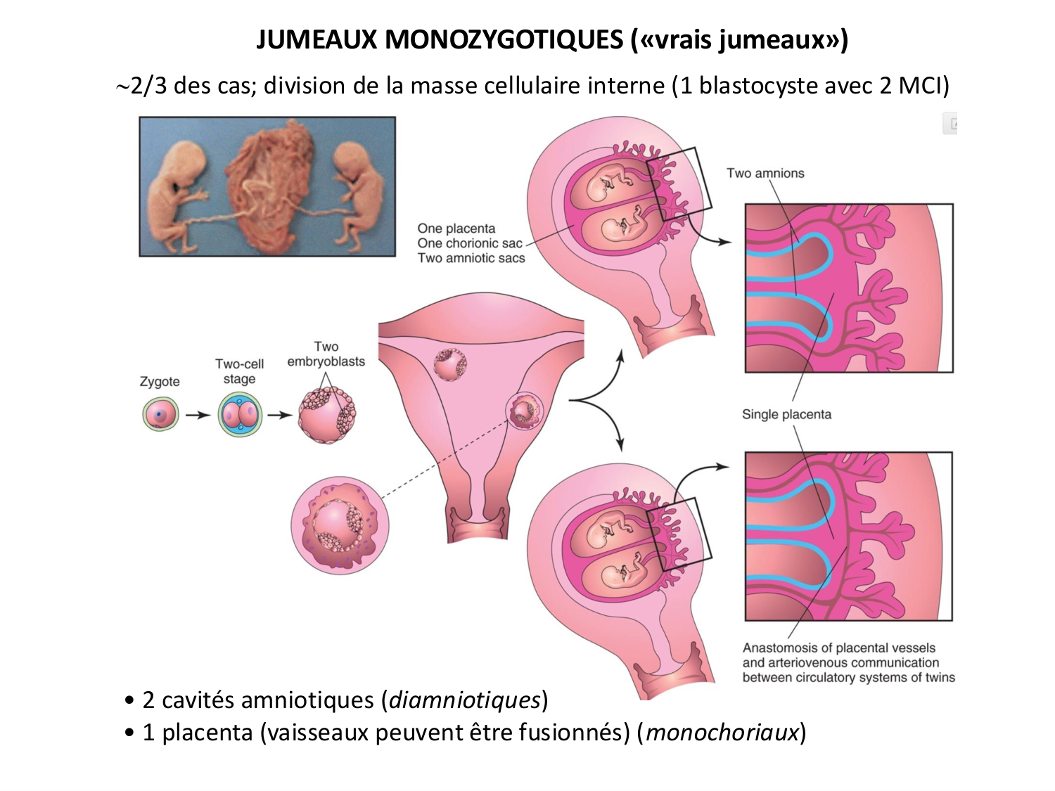 Développement — semaines 1 et 2 page 70