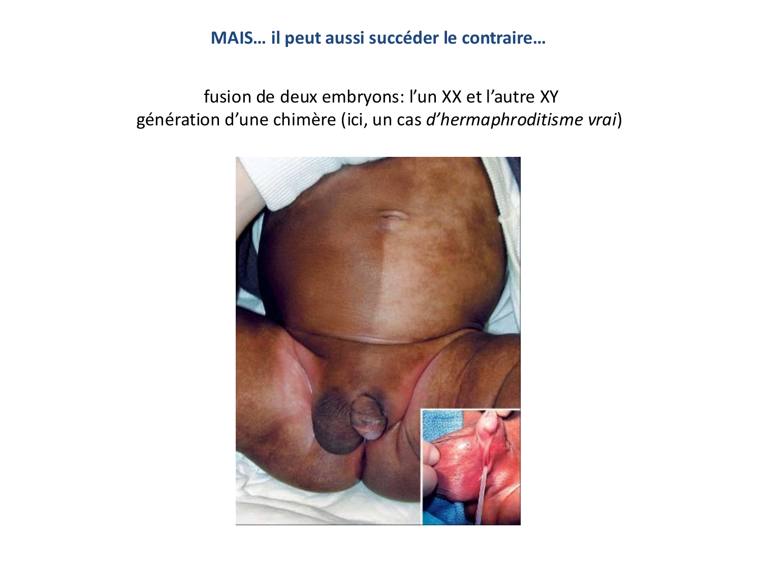 Développement — semaines 1 et 2 page 78