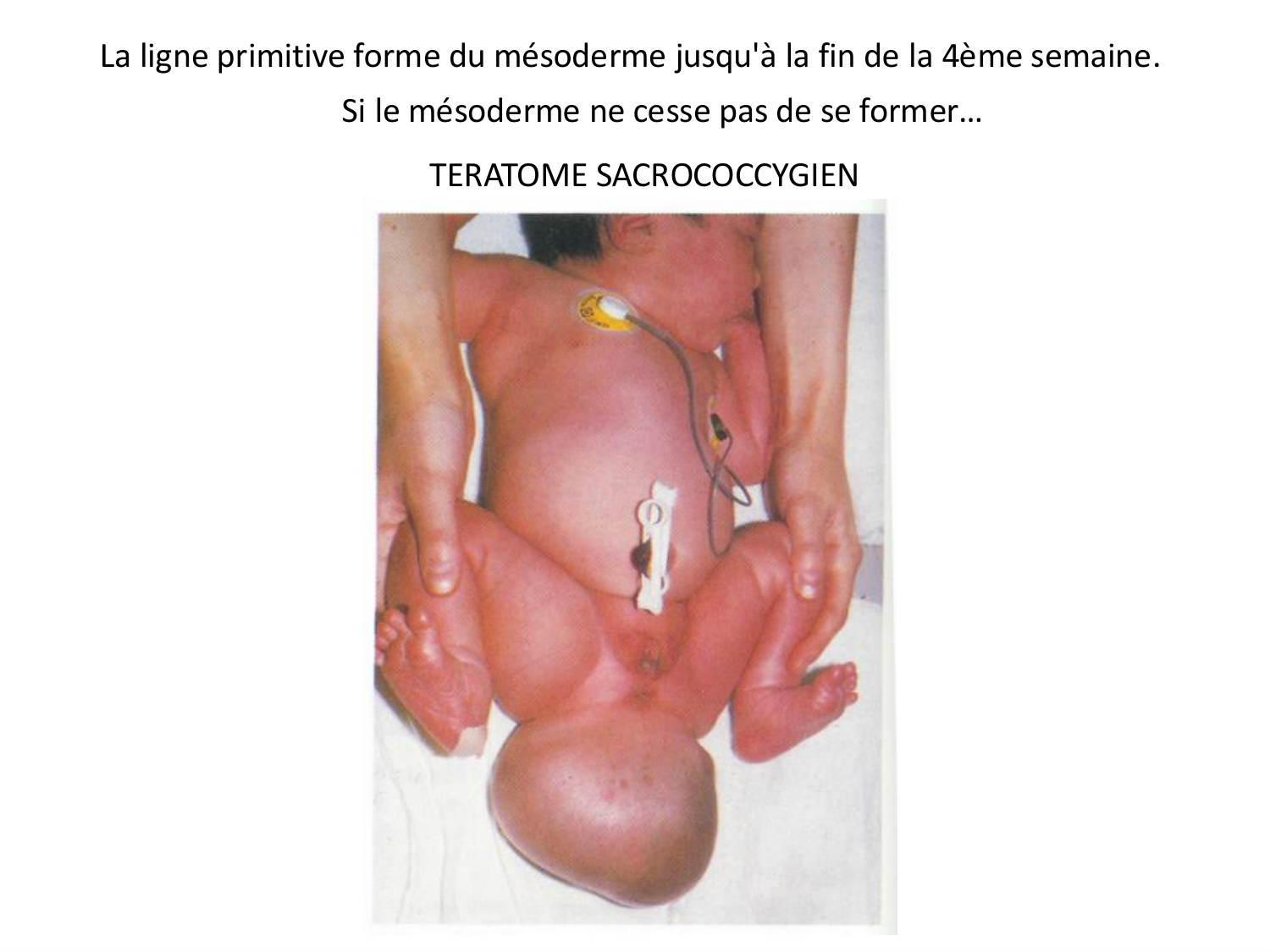 Développement — semaine 3 page 20