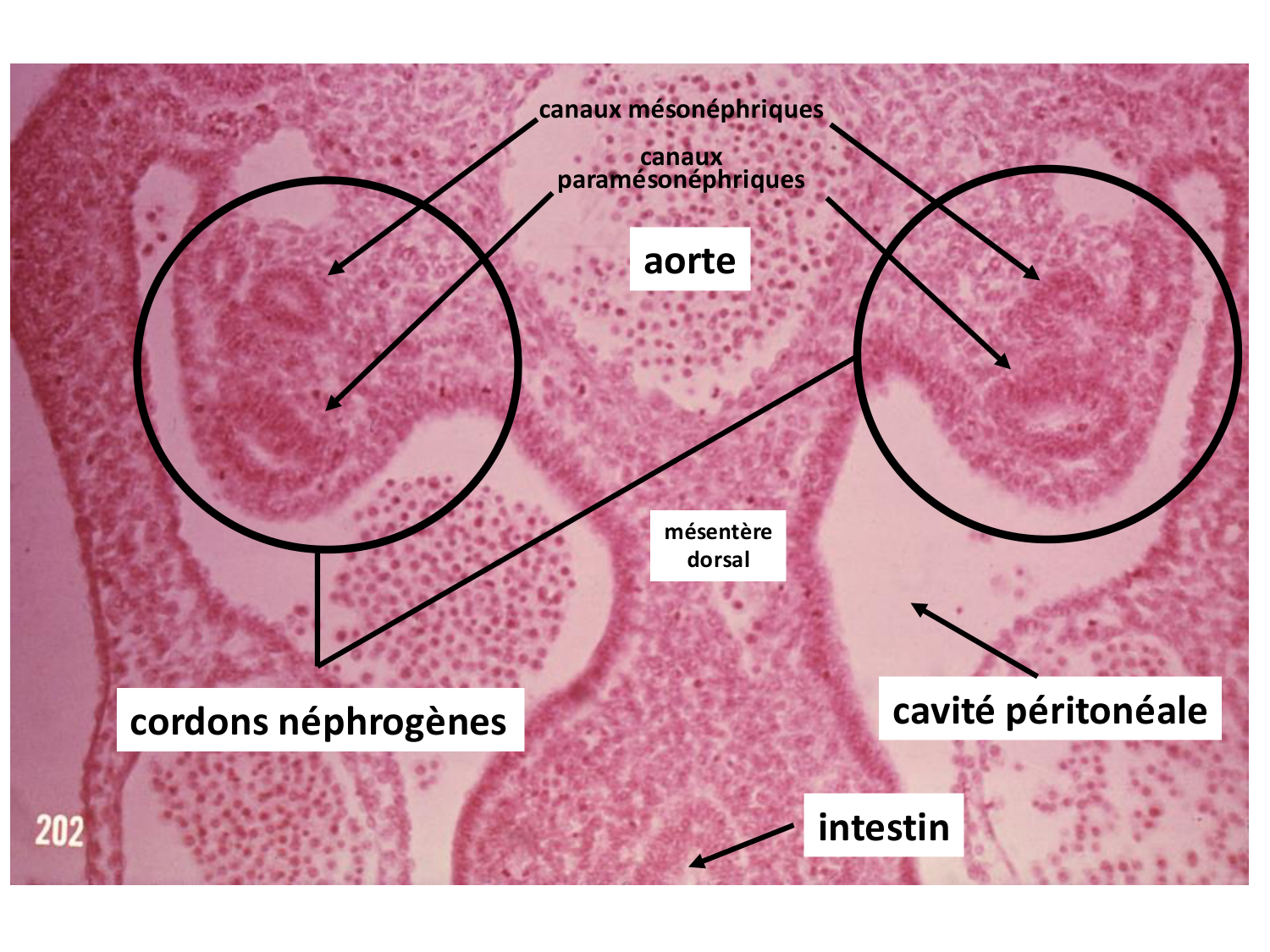 Développement du système urinaire page 17