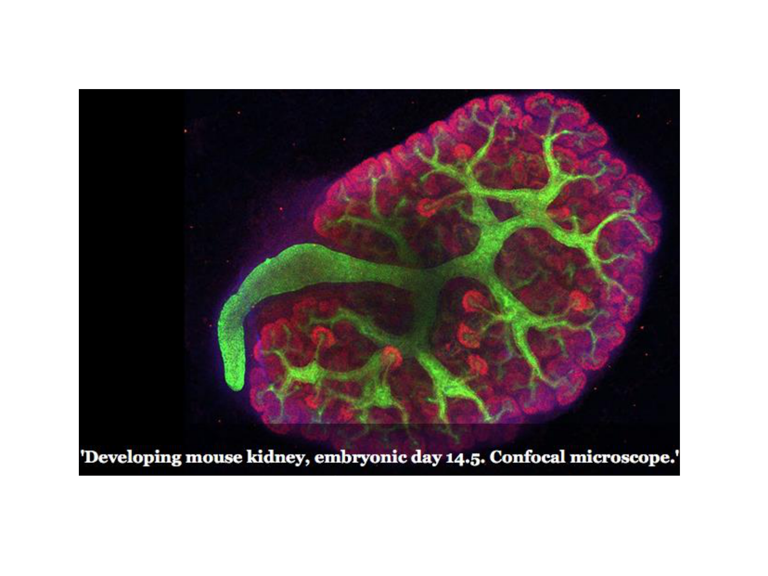 Développement du système urinaire page 34