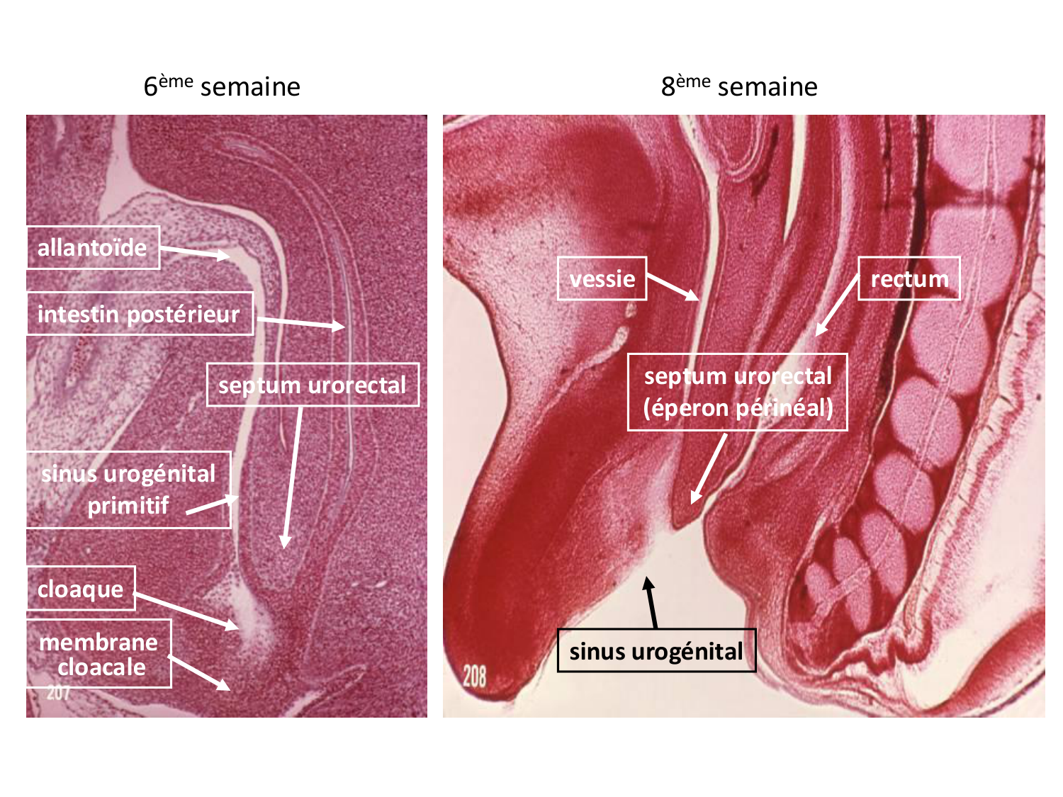 Développement du système urinaire page 57